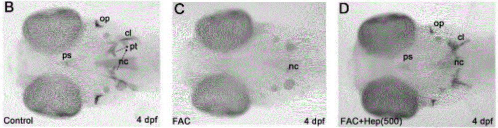 Construction method for zebra fish model using hepcidin to treat high-iron inhibition of bone formation