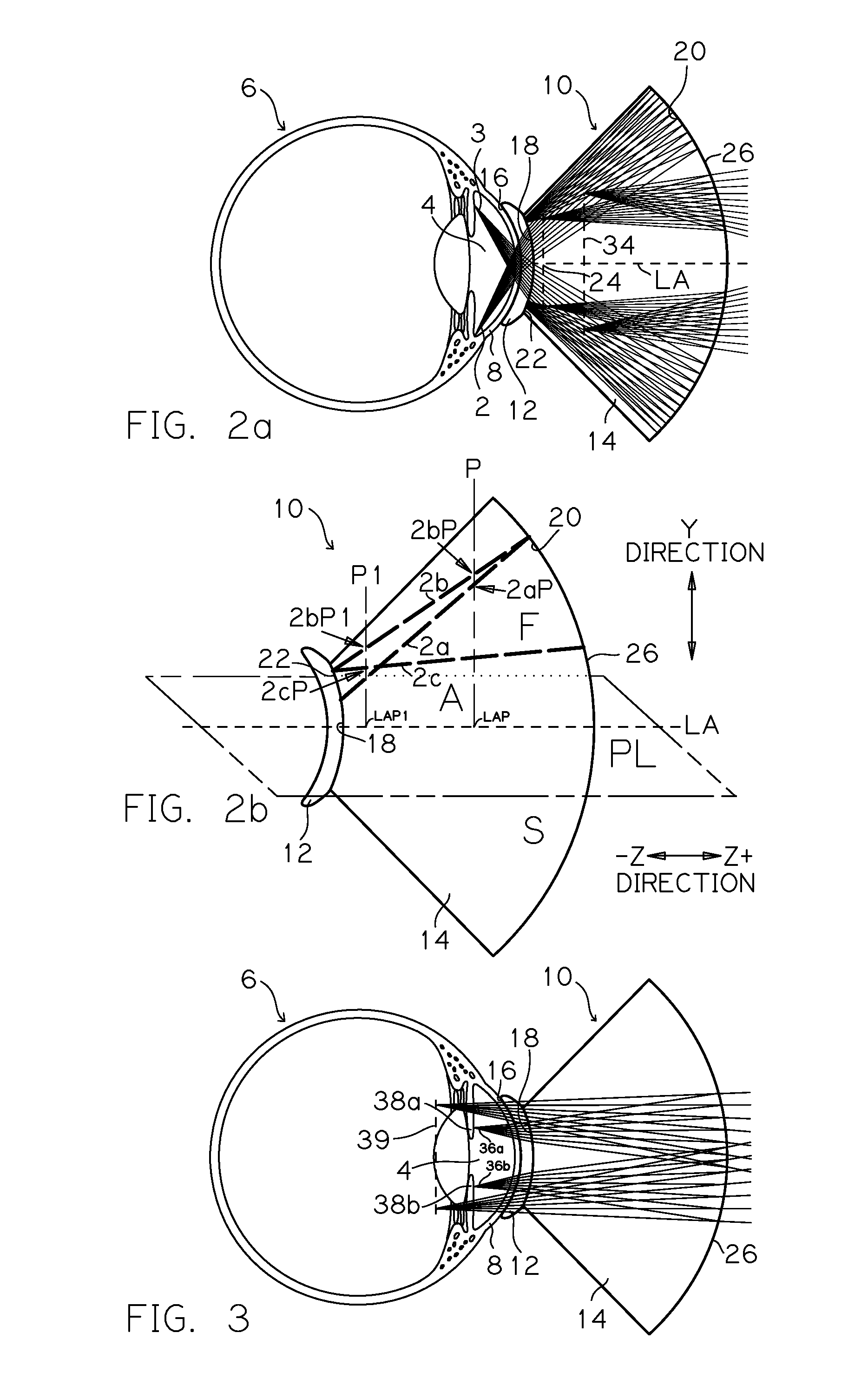 Real image forming eye examination lens utilizing two reflecting surfaces with non-mirrored central viewing area