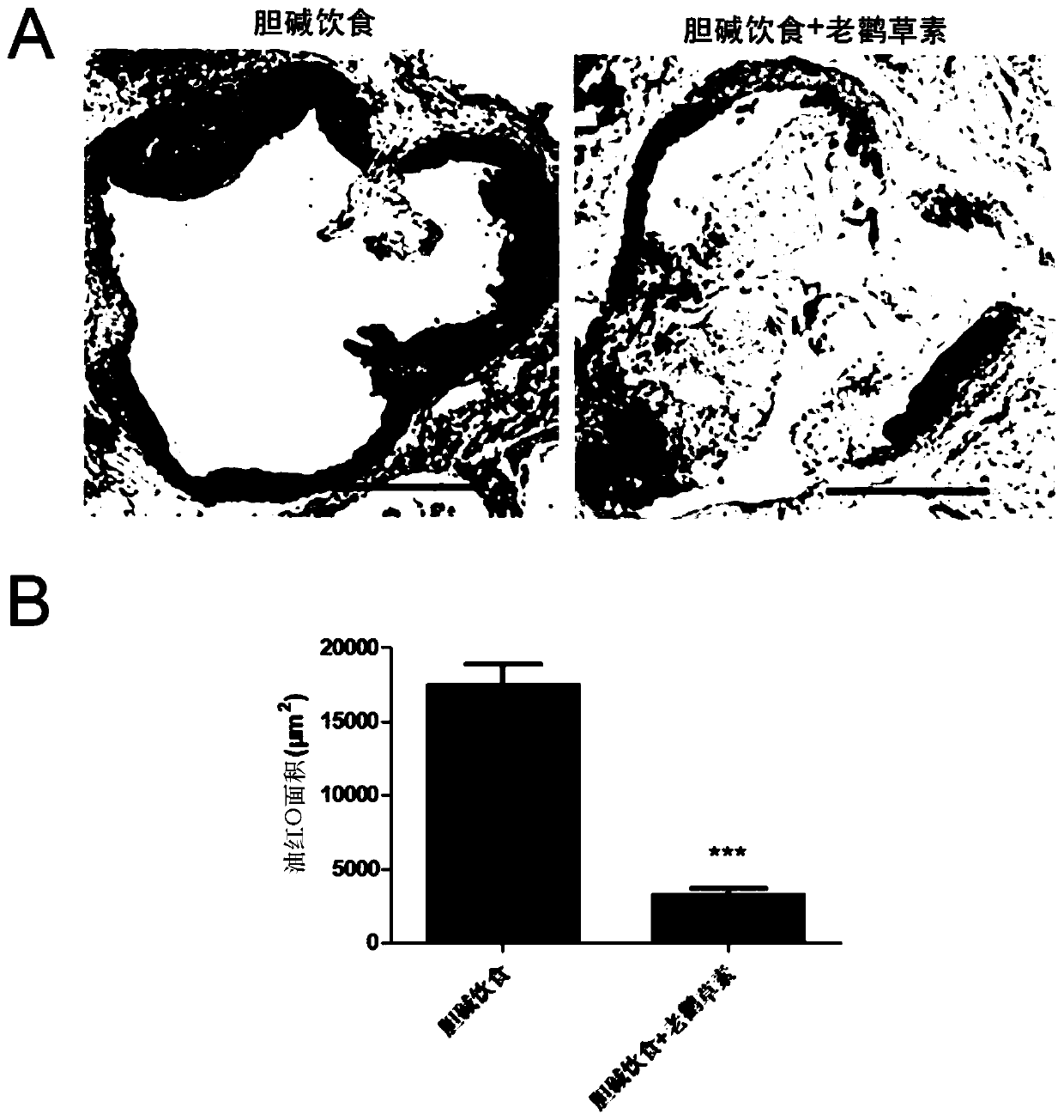 Application of geraniin in preparation of drugs to prevent or treat atherosclerosis