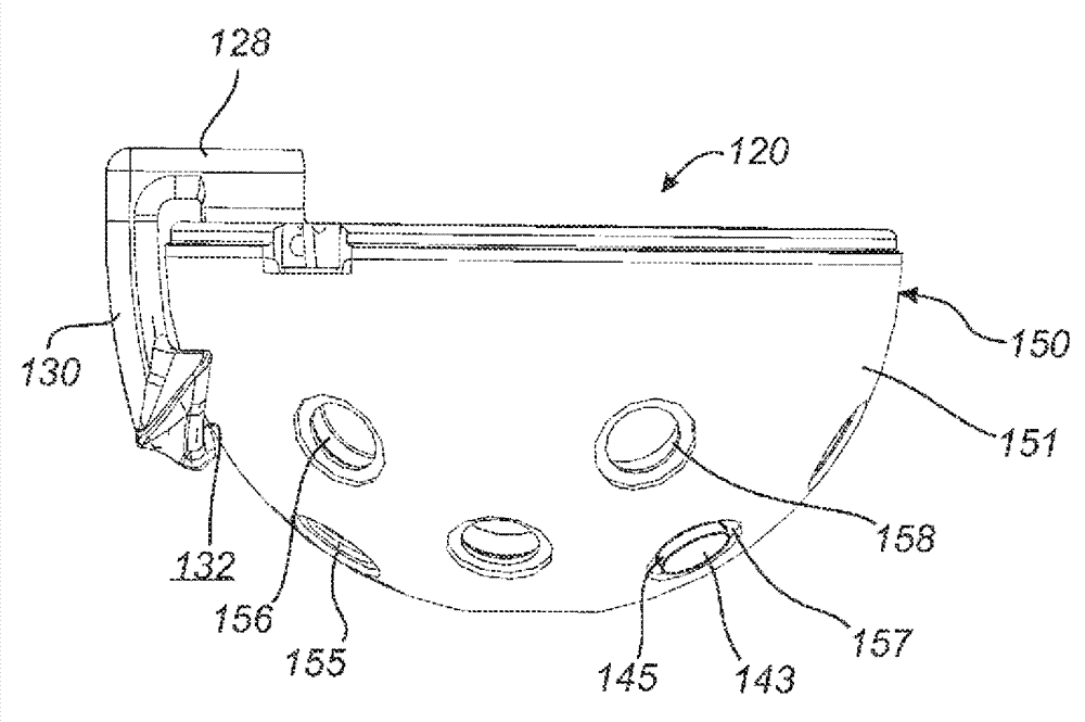 Prosthesis guide comprising patient-matched features