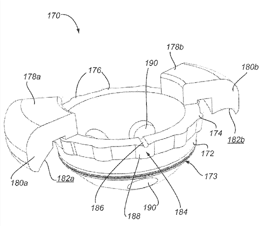 Prosthesis guide comprising patient-matched features