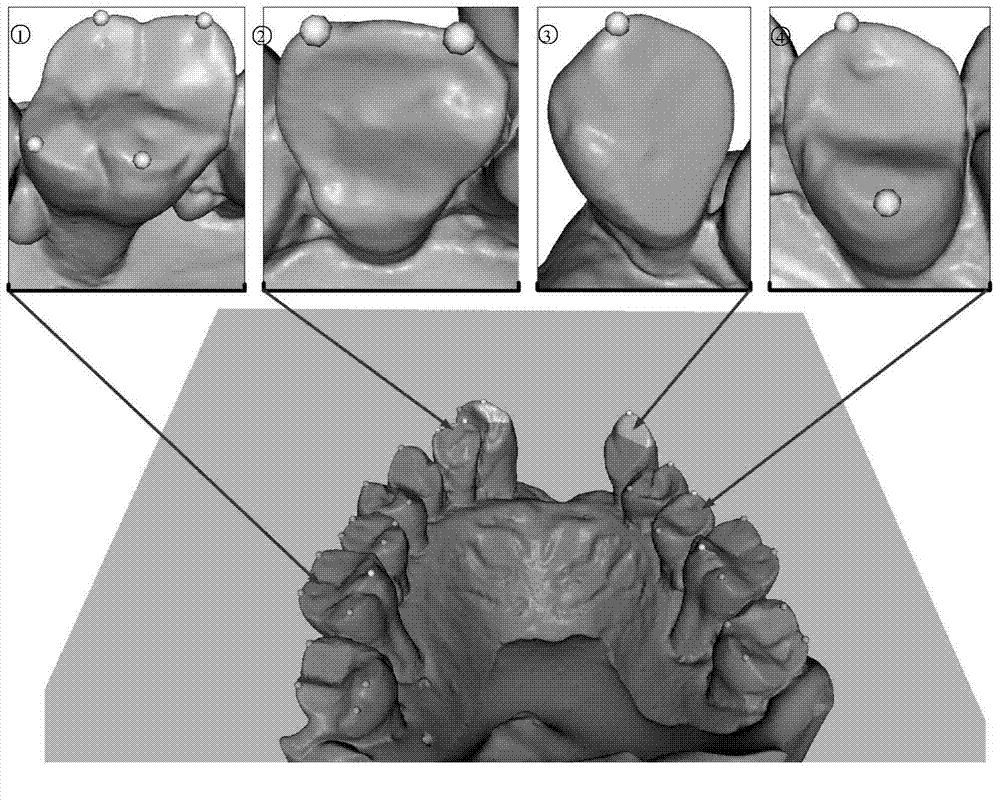 Automatic whole dental crown segmentation method through harmonic-field-based three-dimensional tooth jaw model