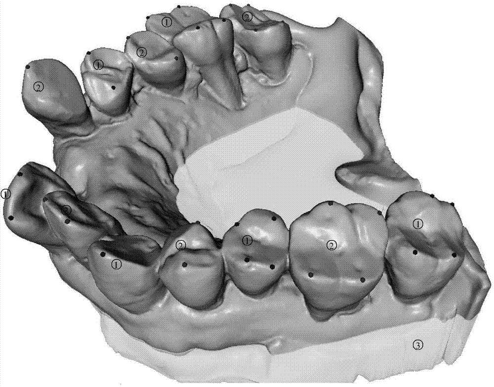 Automatic whole dental crown segmentation method through harmonic-field-based three-dimensional tooth jaw model