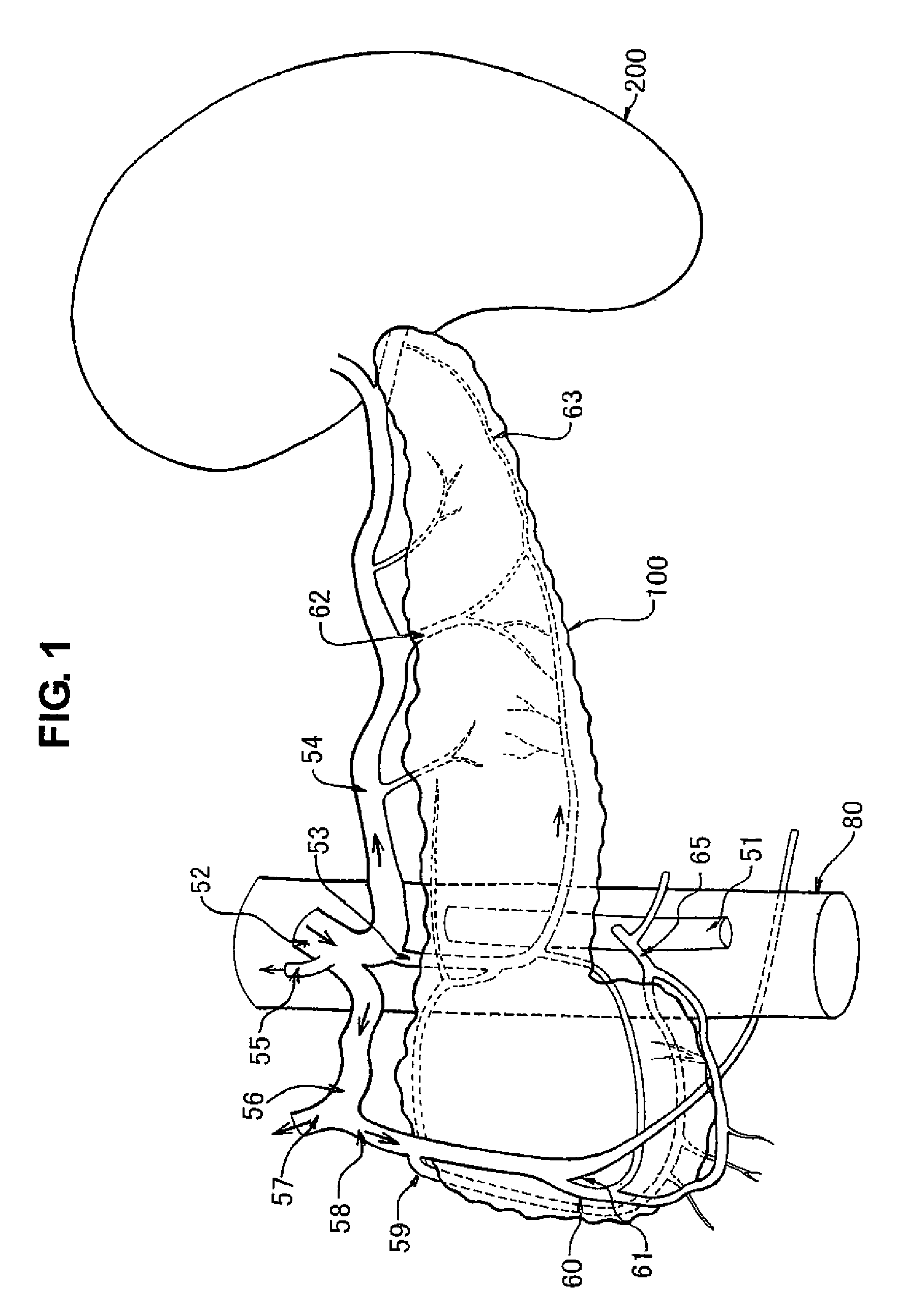Perfusion System for Pancreas Treatment