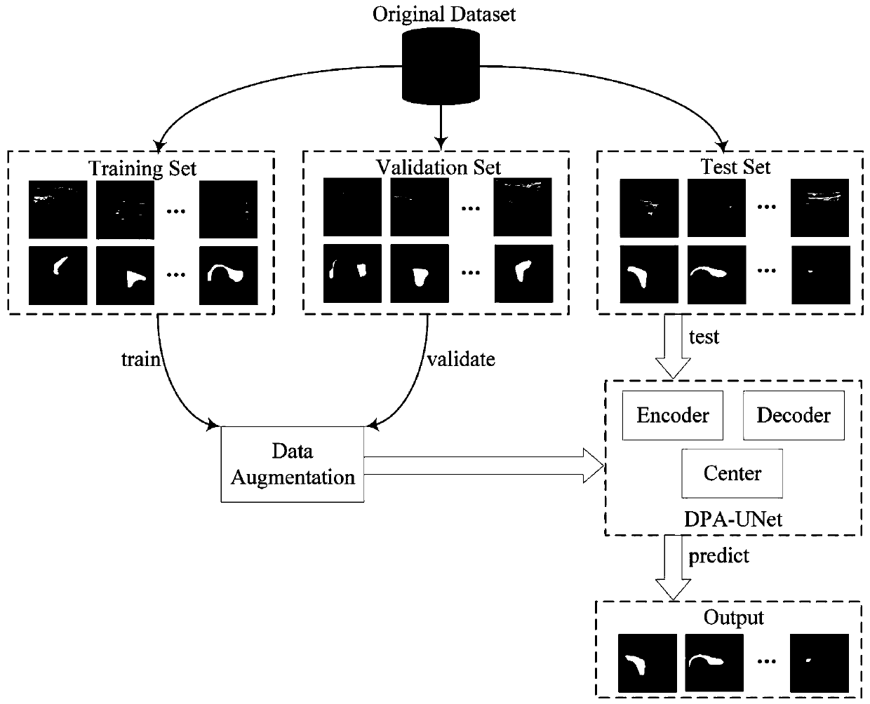 Medical image segmentation method based on deep learning