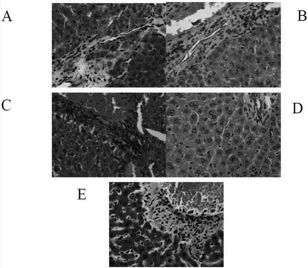 Application of psoralea corylifolia in preparation of medicine for treating children fatty liver