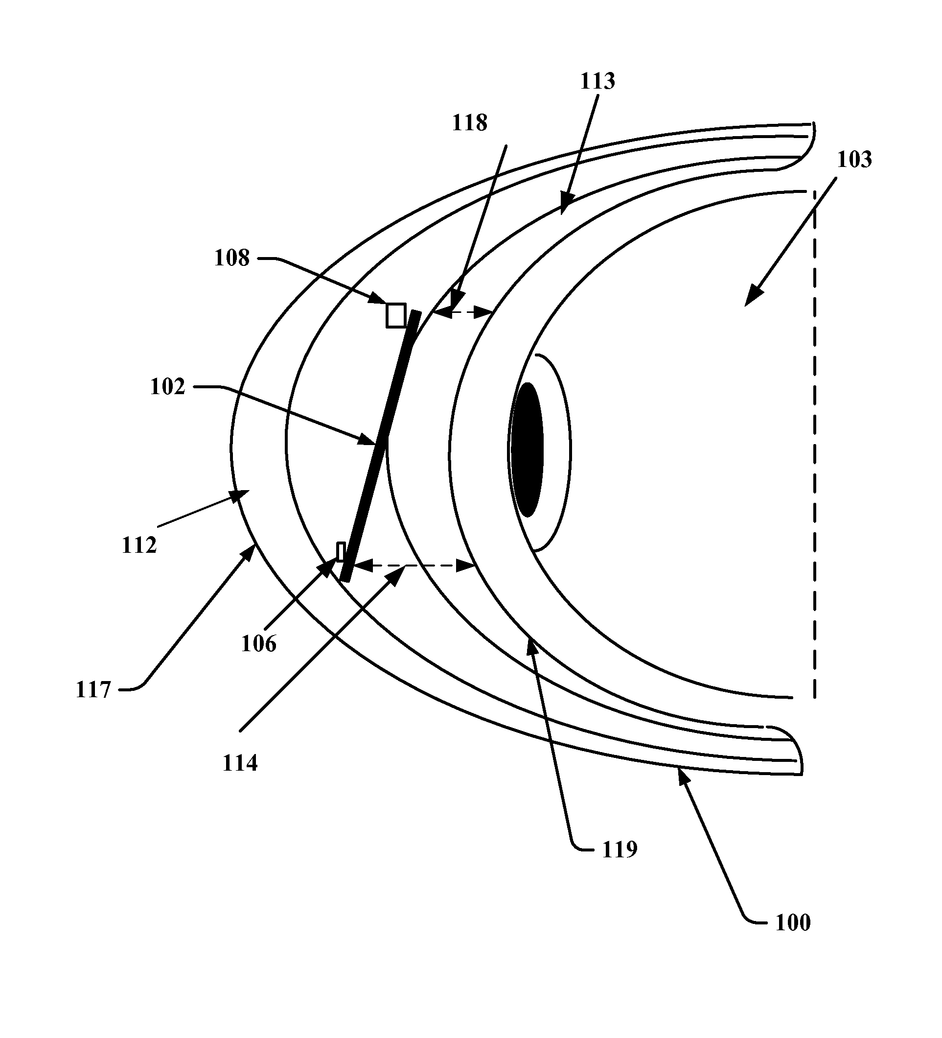 Contact lens and method of manufacture to improve sensor sensitivity