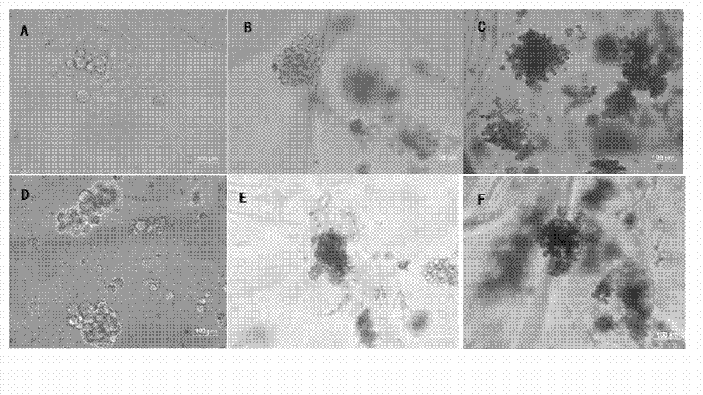Hydrogel for three-dimensional culturing of tumor cells and applications thereof