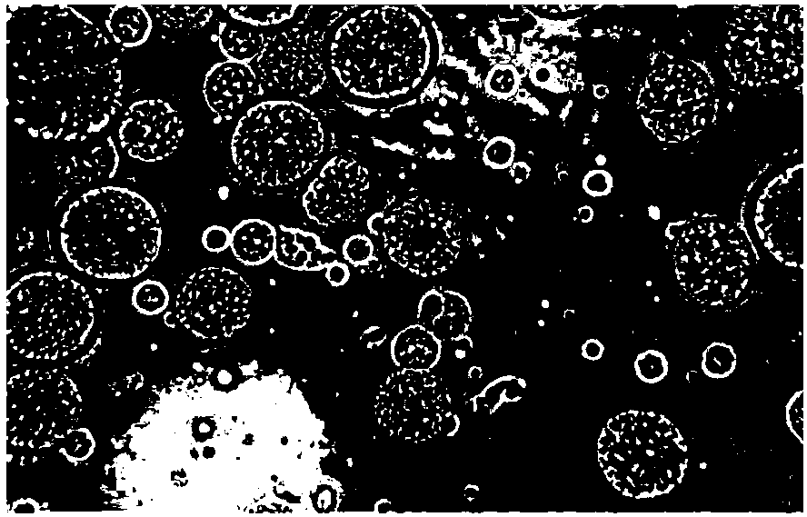 Liraglutide multivesicular liposome and preparation method and application thereof