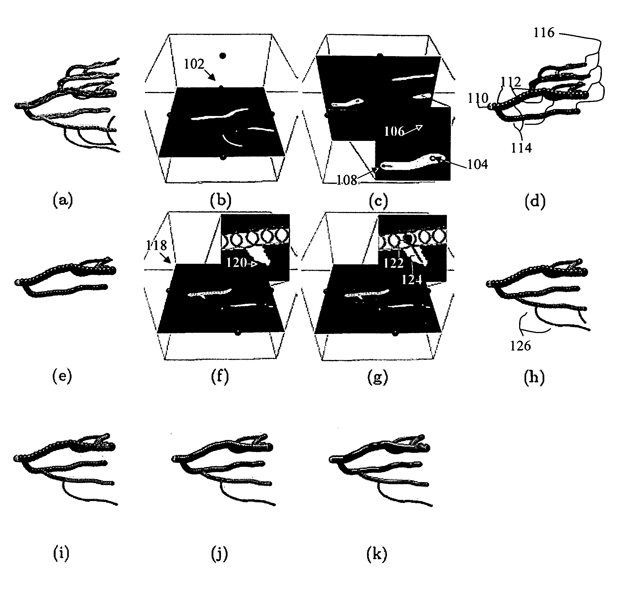 Method and system for segmentation of tubular structures in 3D images