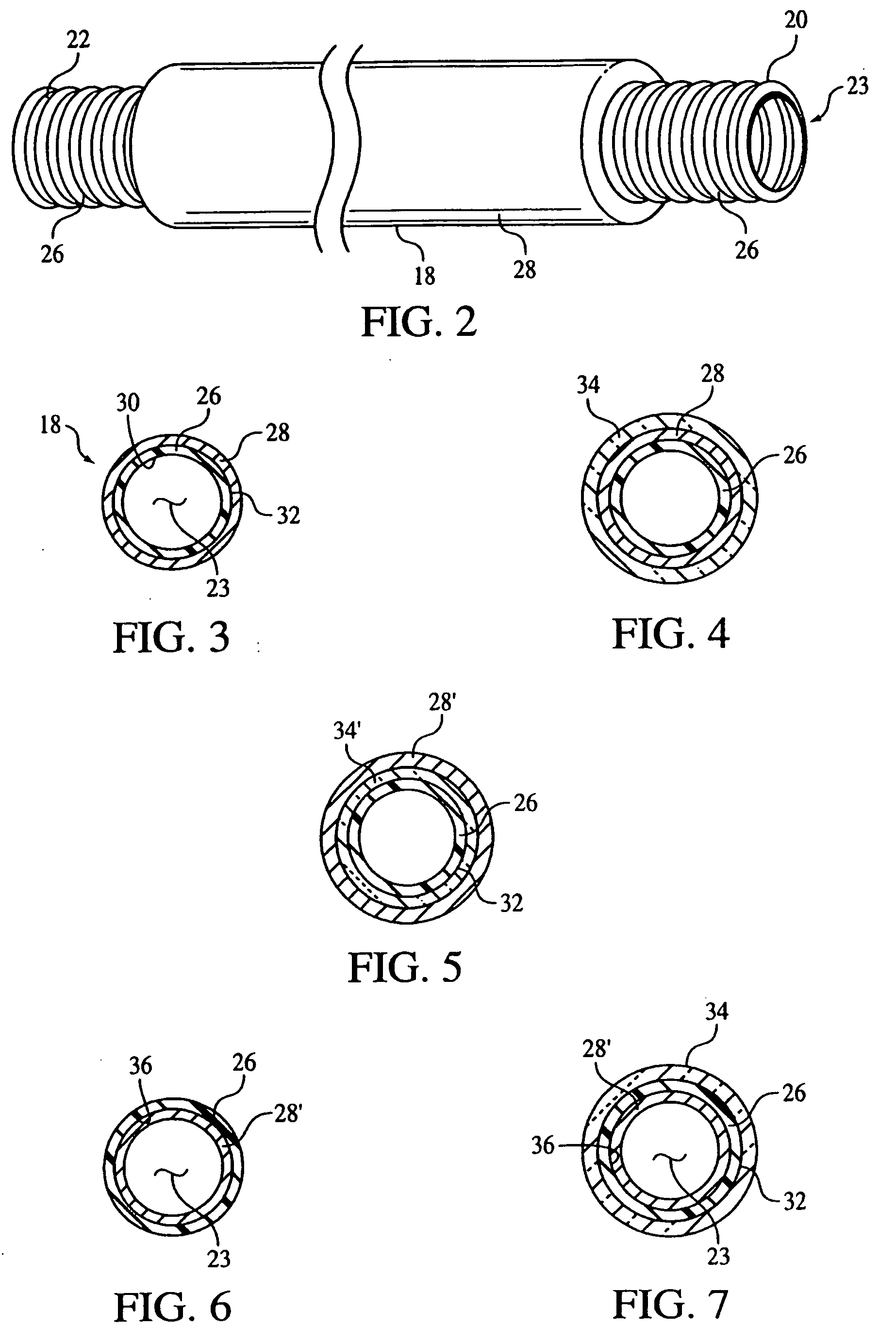 Condensation reduction and management systems in a gas flow delivery system