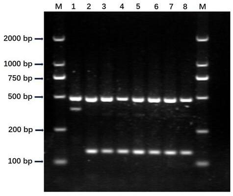 Rice bacterial blight resistance gene xa5 specific molecular marker and application thereof