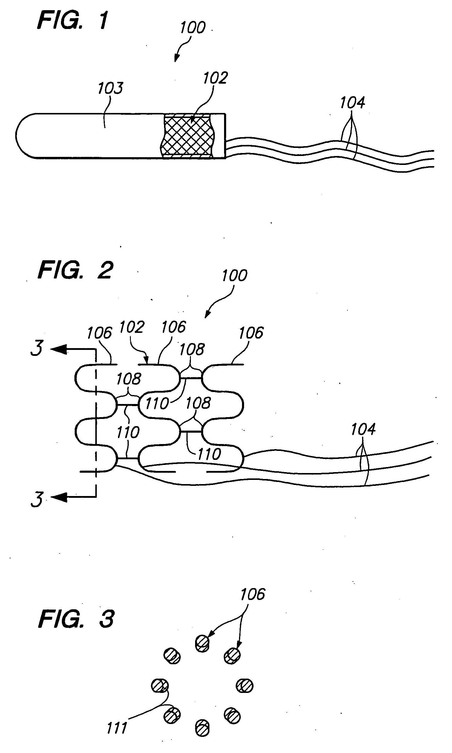 Intravascular self-anchoring electrode body with springs loops or arms