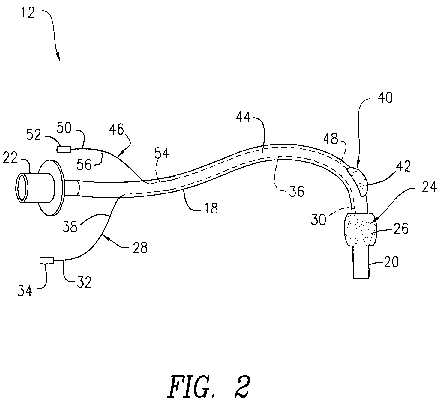 System and method for transcutaneous monitoring of endotracheal tube placement