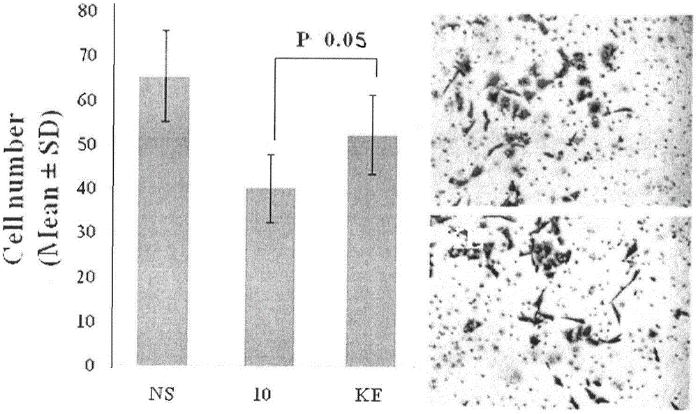 Lys-Glu modified curcumin and preparation thereof, as well as biological activity and application