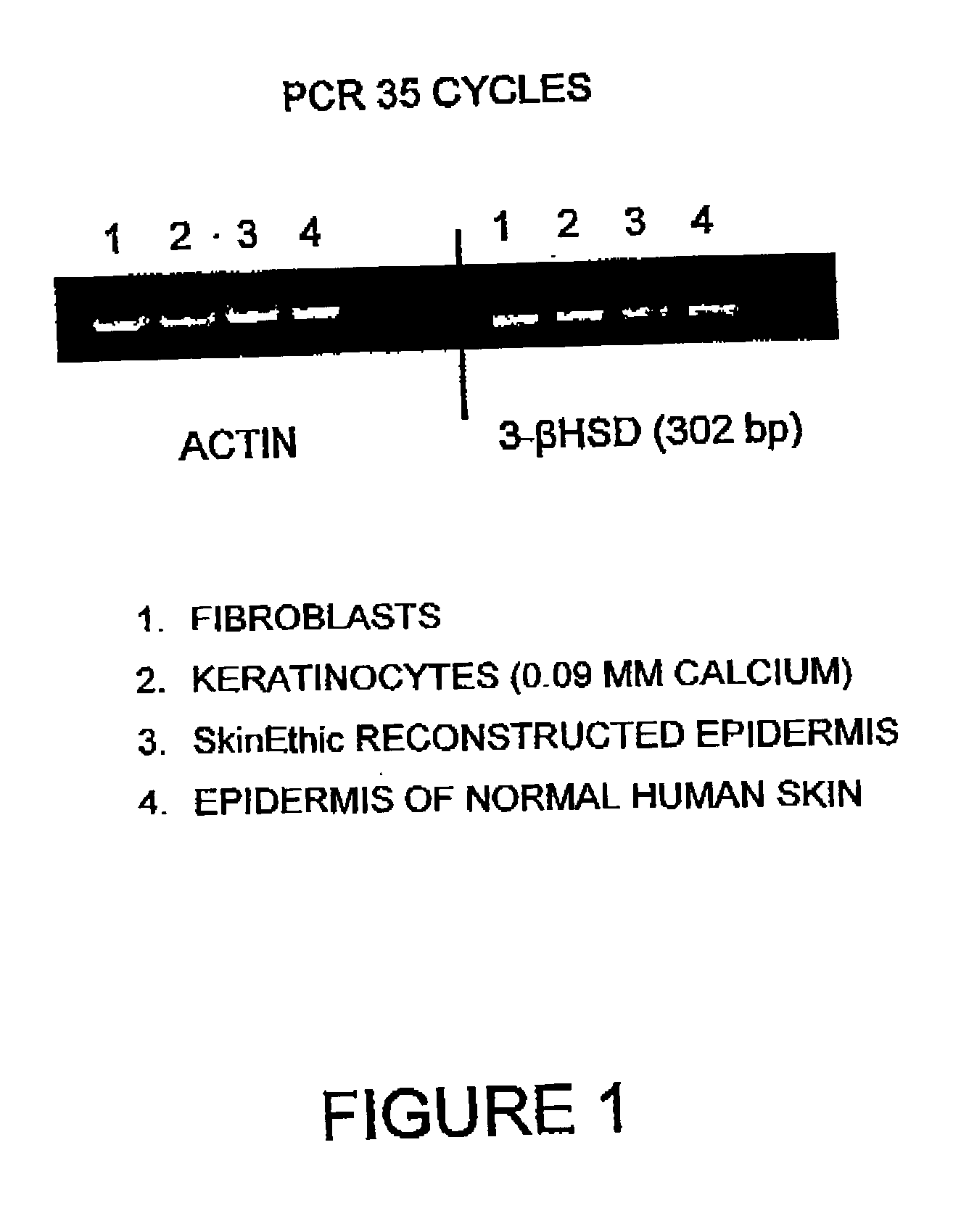 Composition containing at least one inhibitor of the enzyme 3-beta-HSD