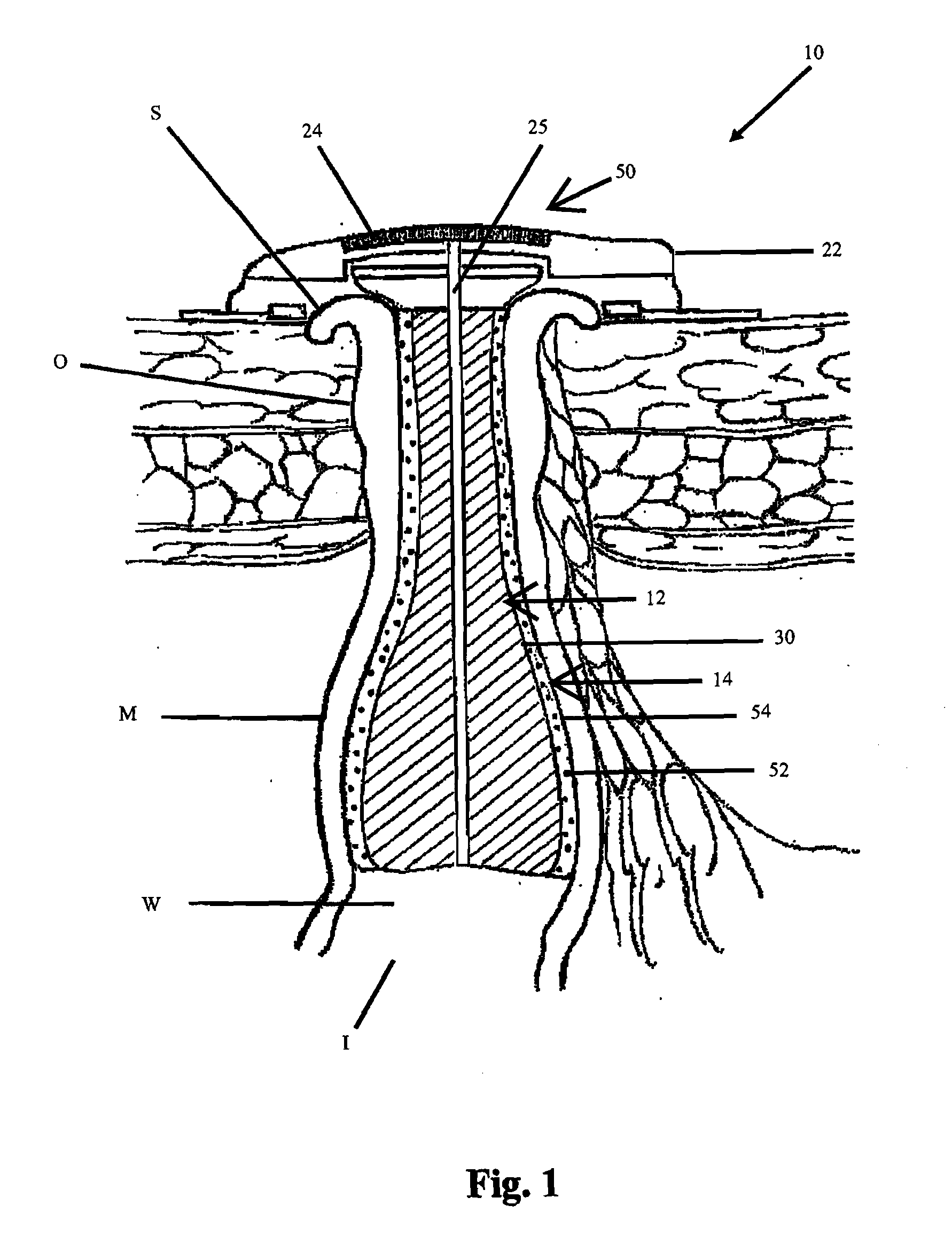 Continent ostomy system with chemical neuromuscular control