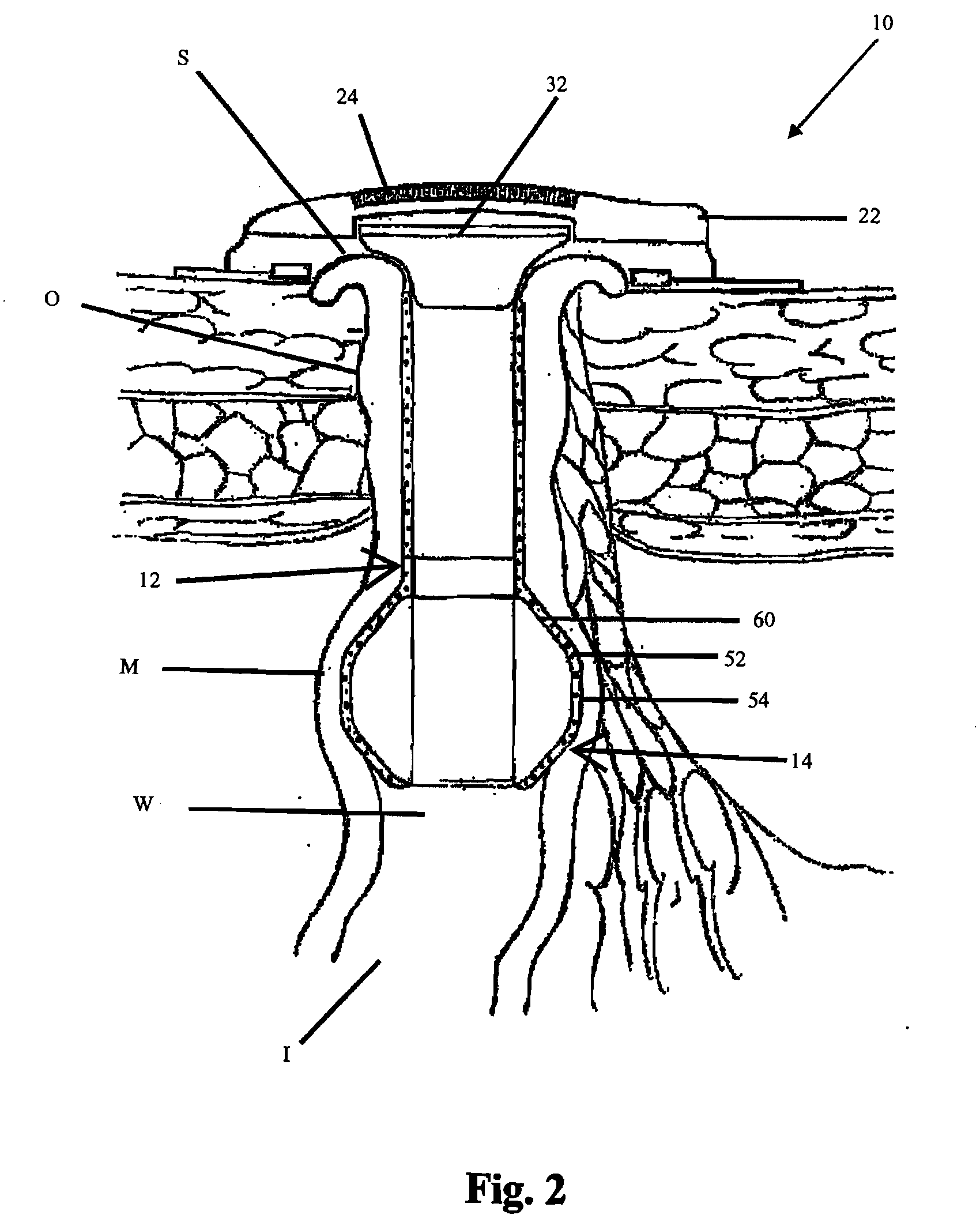Continent ostomy system with chemical neuromuscular control