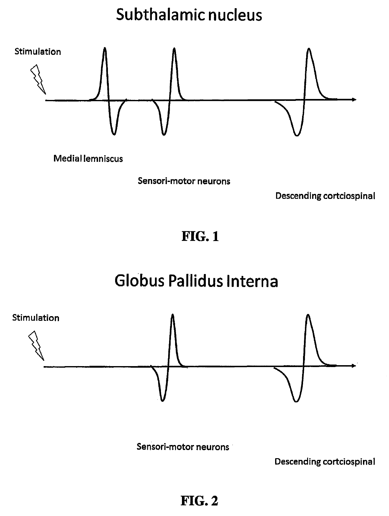 Method and system for physiological target localization from macroelectrode recordings and monitoring spinal cord function