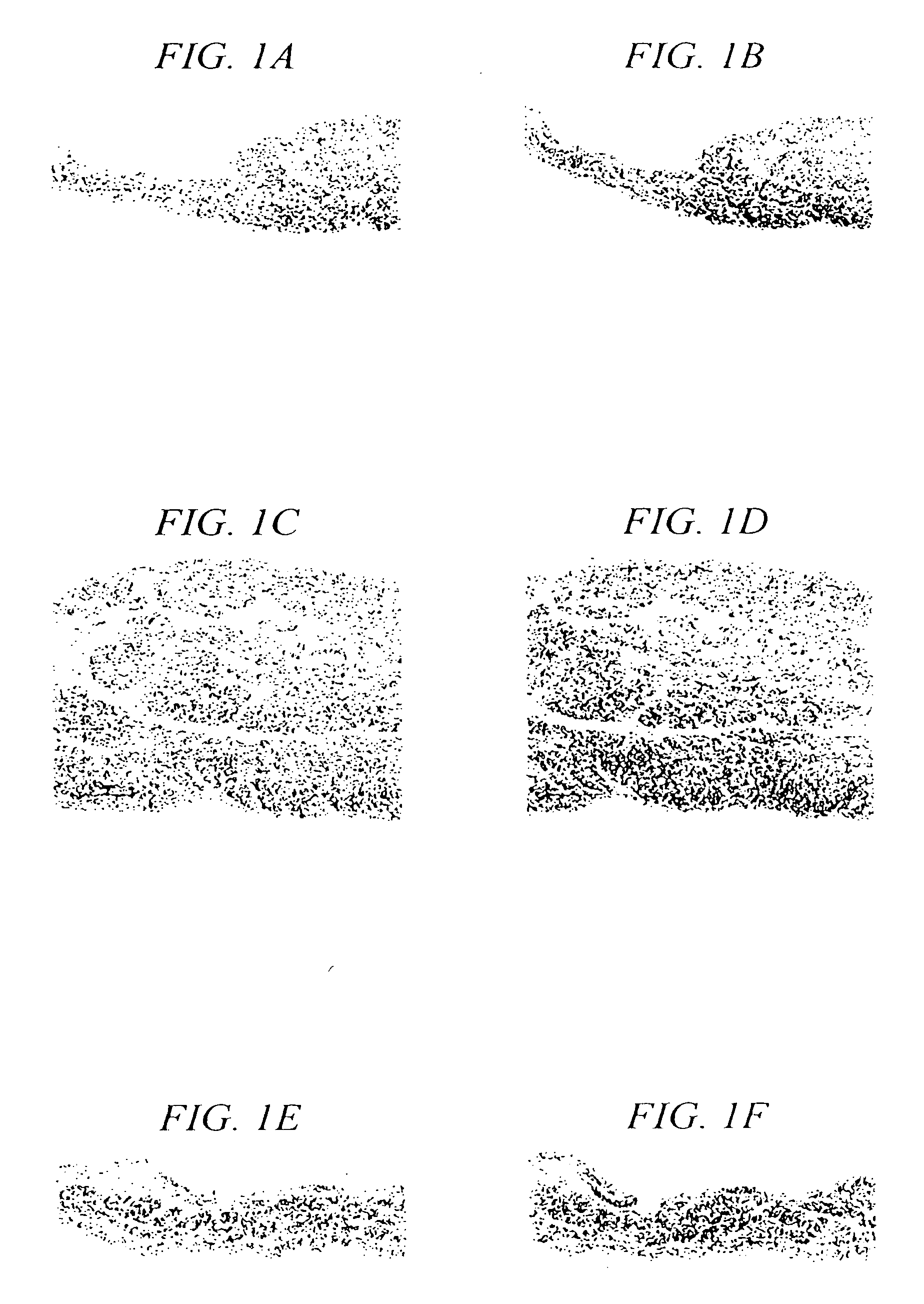 Method and apparatus for locating the fossa ovalis and performing transseptal puncture
