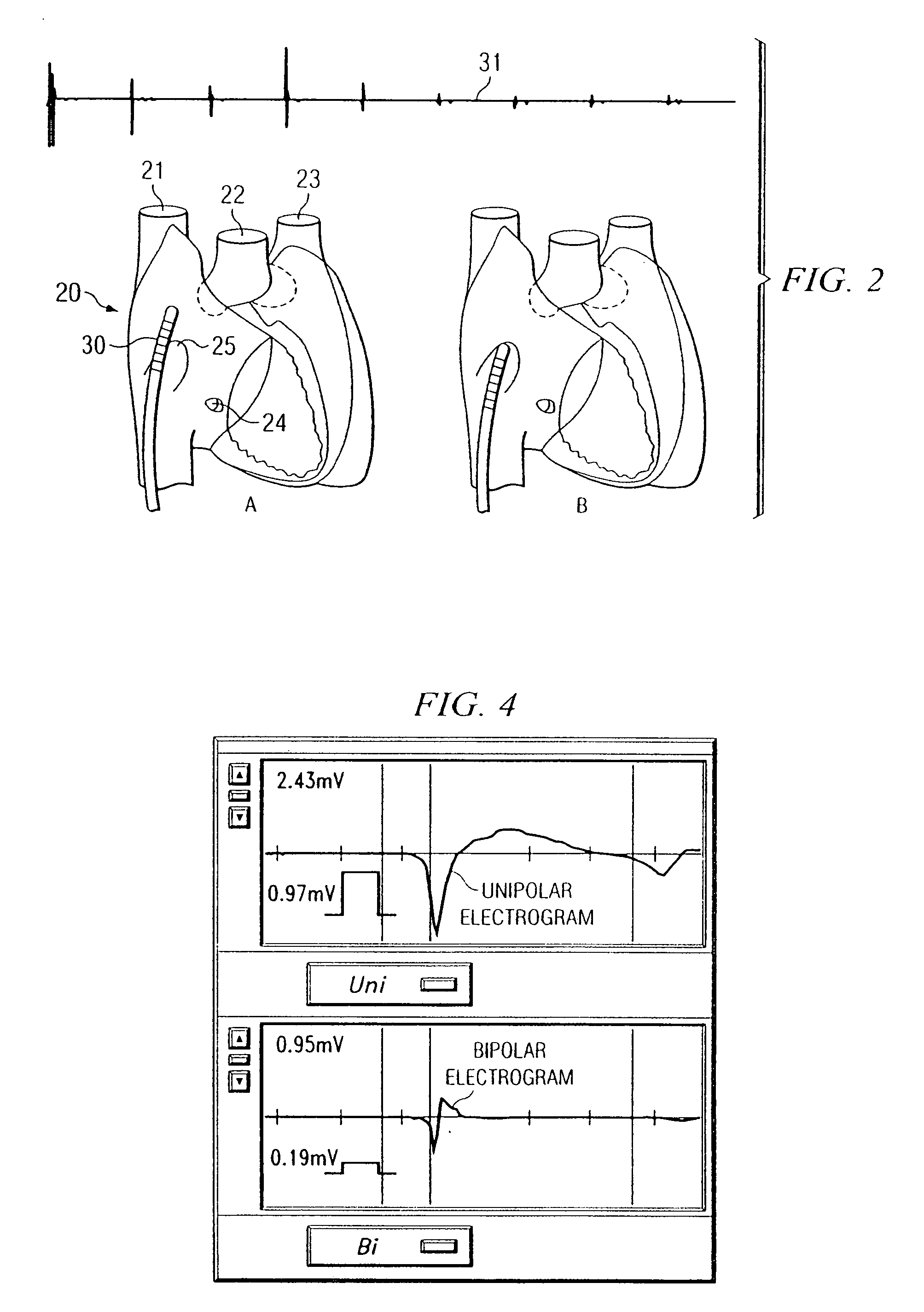 Method and apparatus for locating the fossa ovalis and performing transseptal puncture