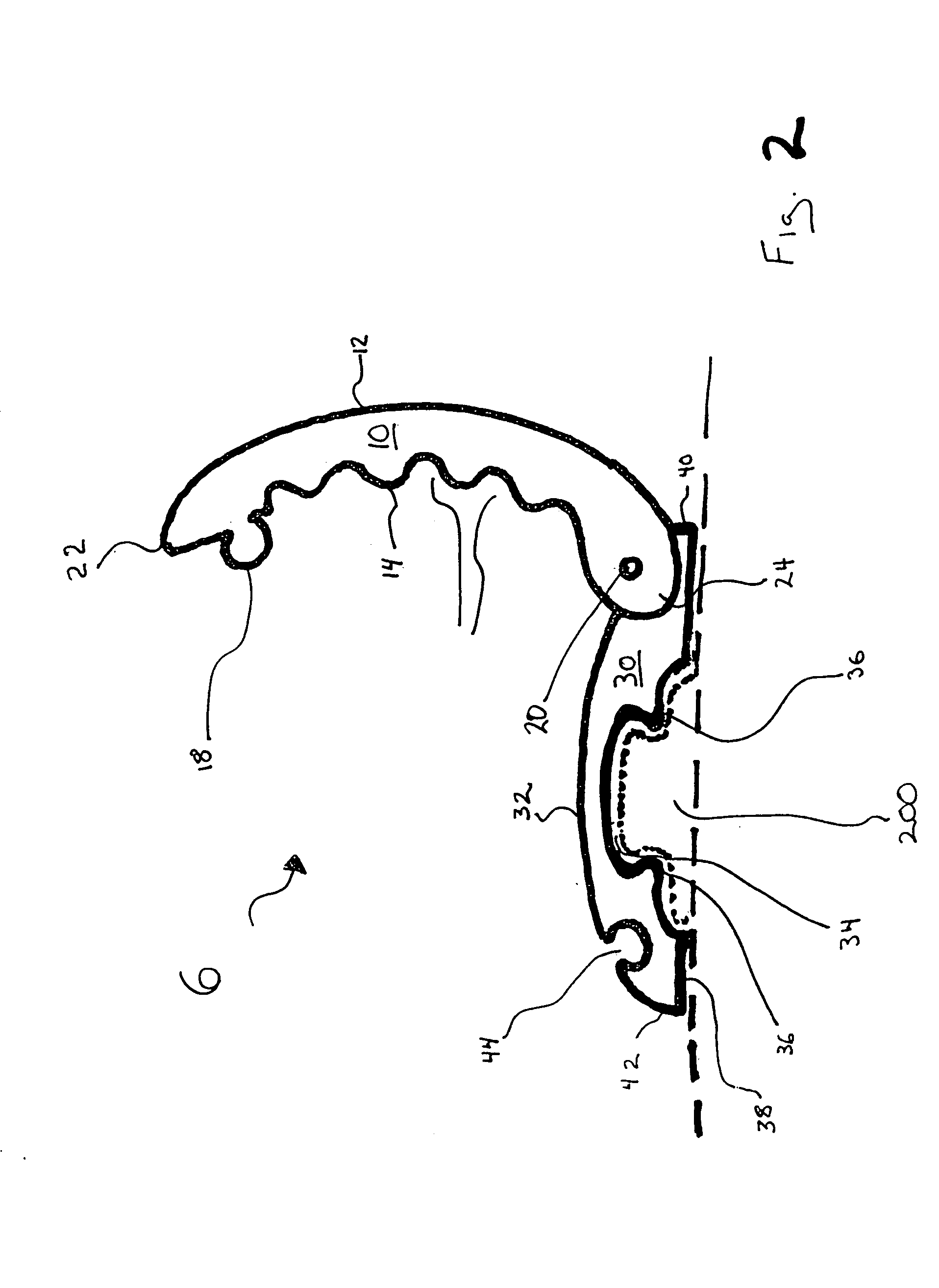 Variable tension fastening system for vehicle covers