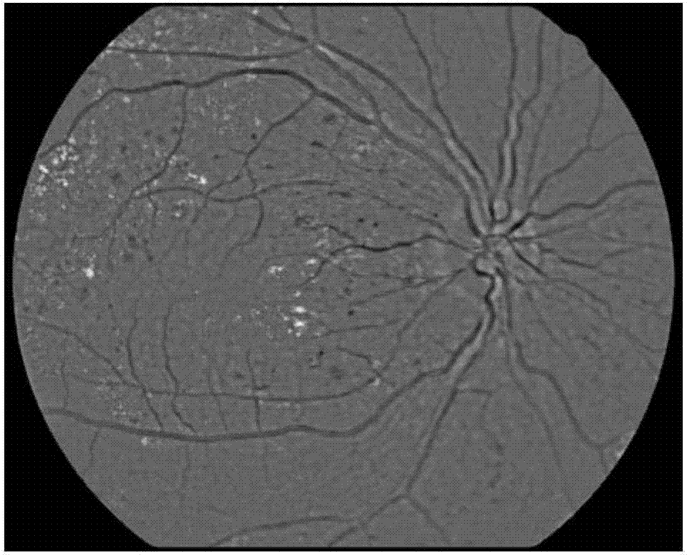 Eye fundus image quality control method