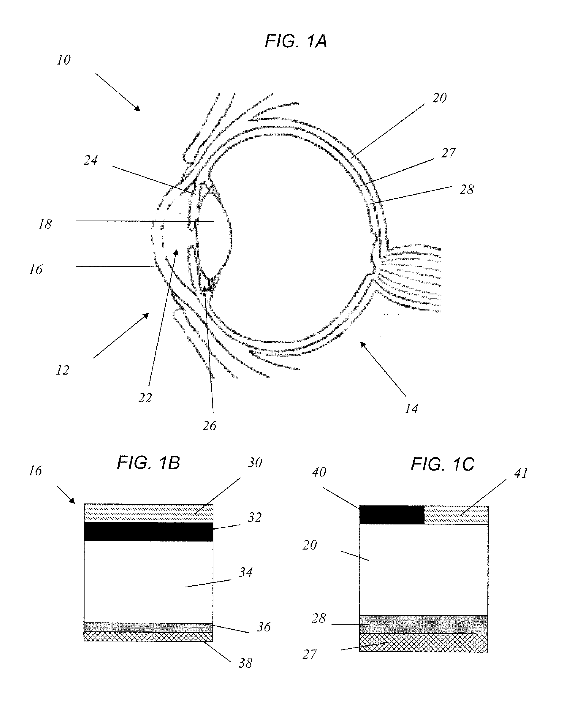 Method for drug delivery to ocular tissue using microneedle