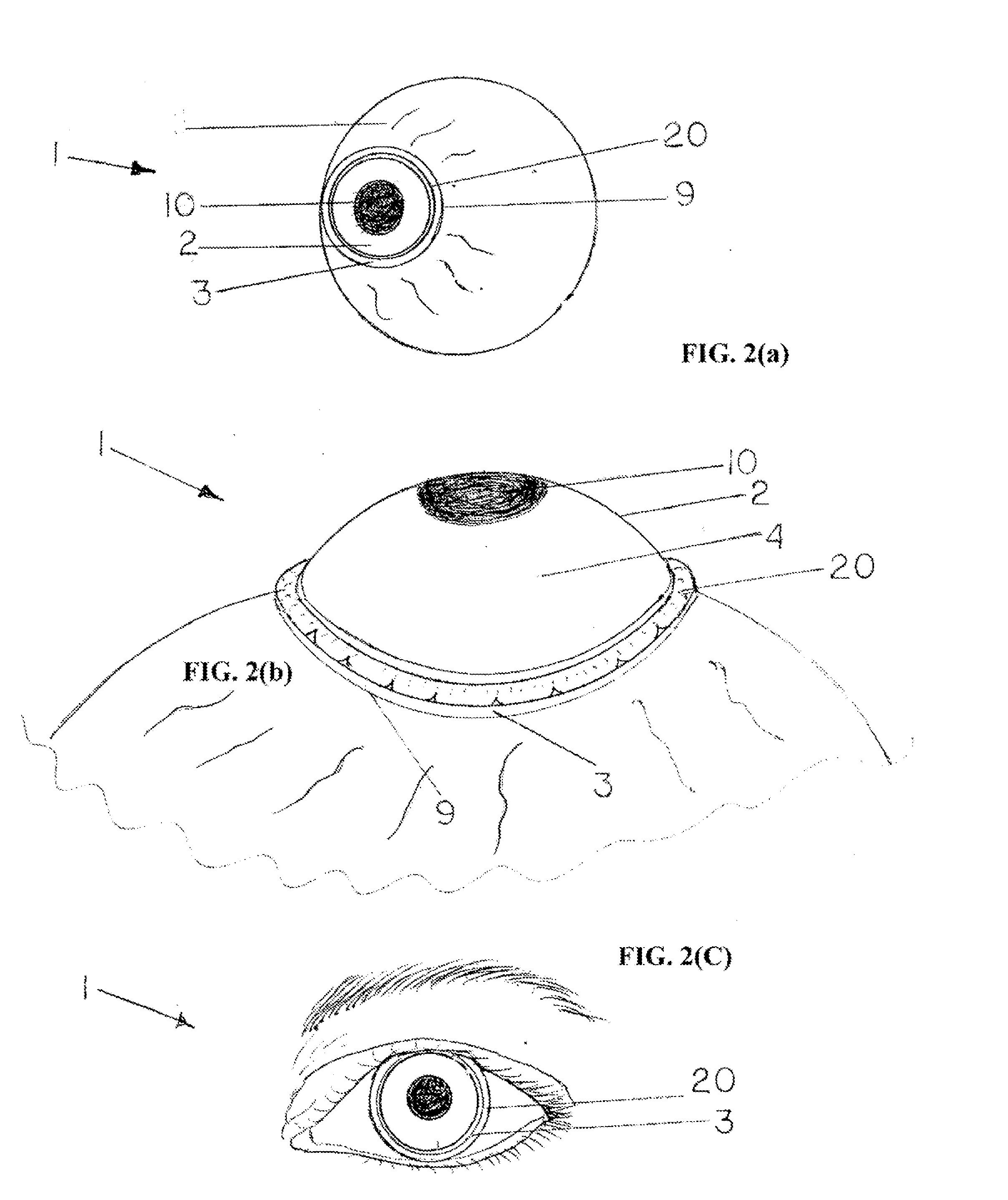 System and Device for Correcting Hyperopia and Presbyopia