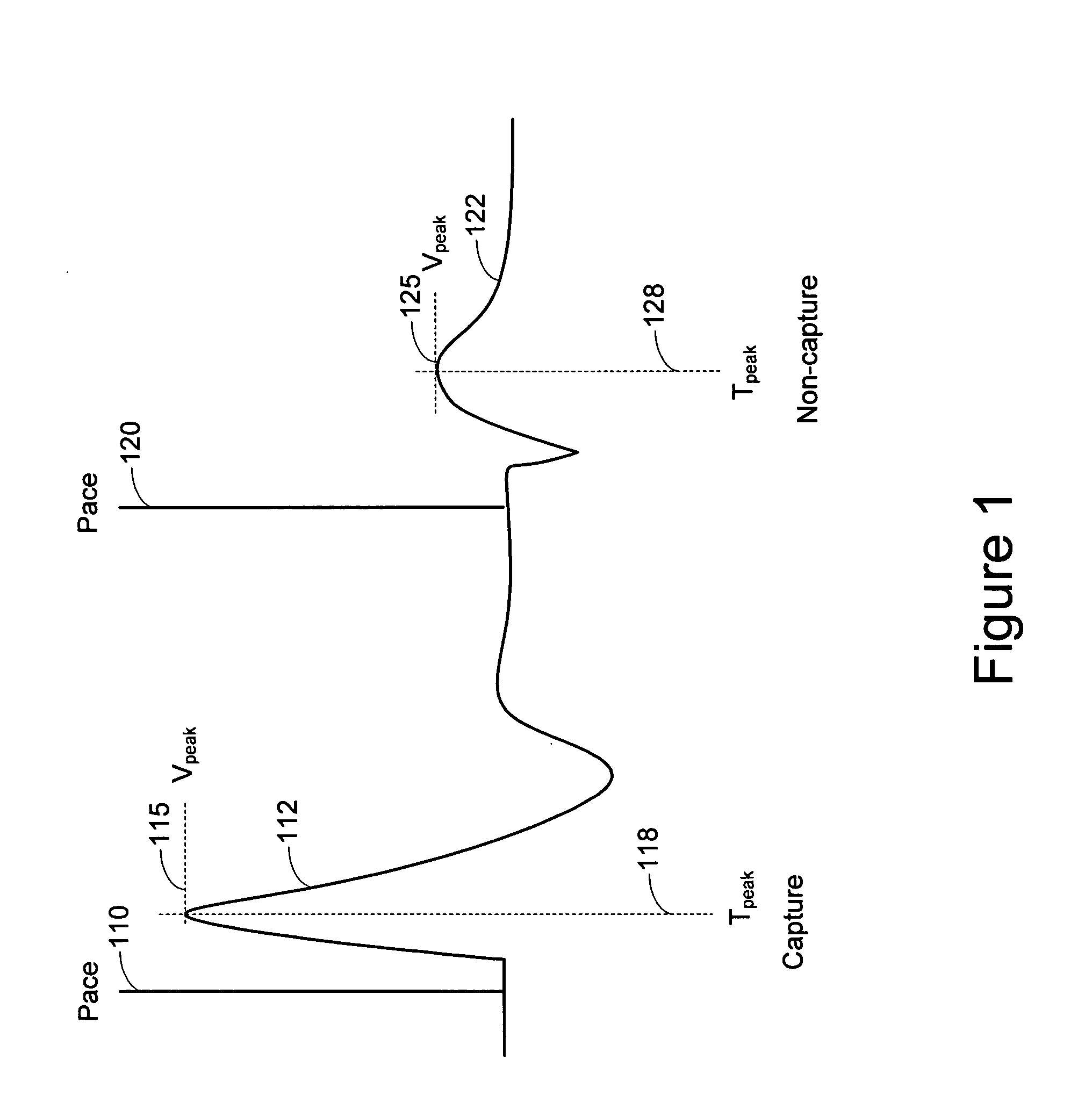 Template initialization for evoked response detection