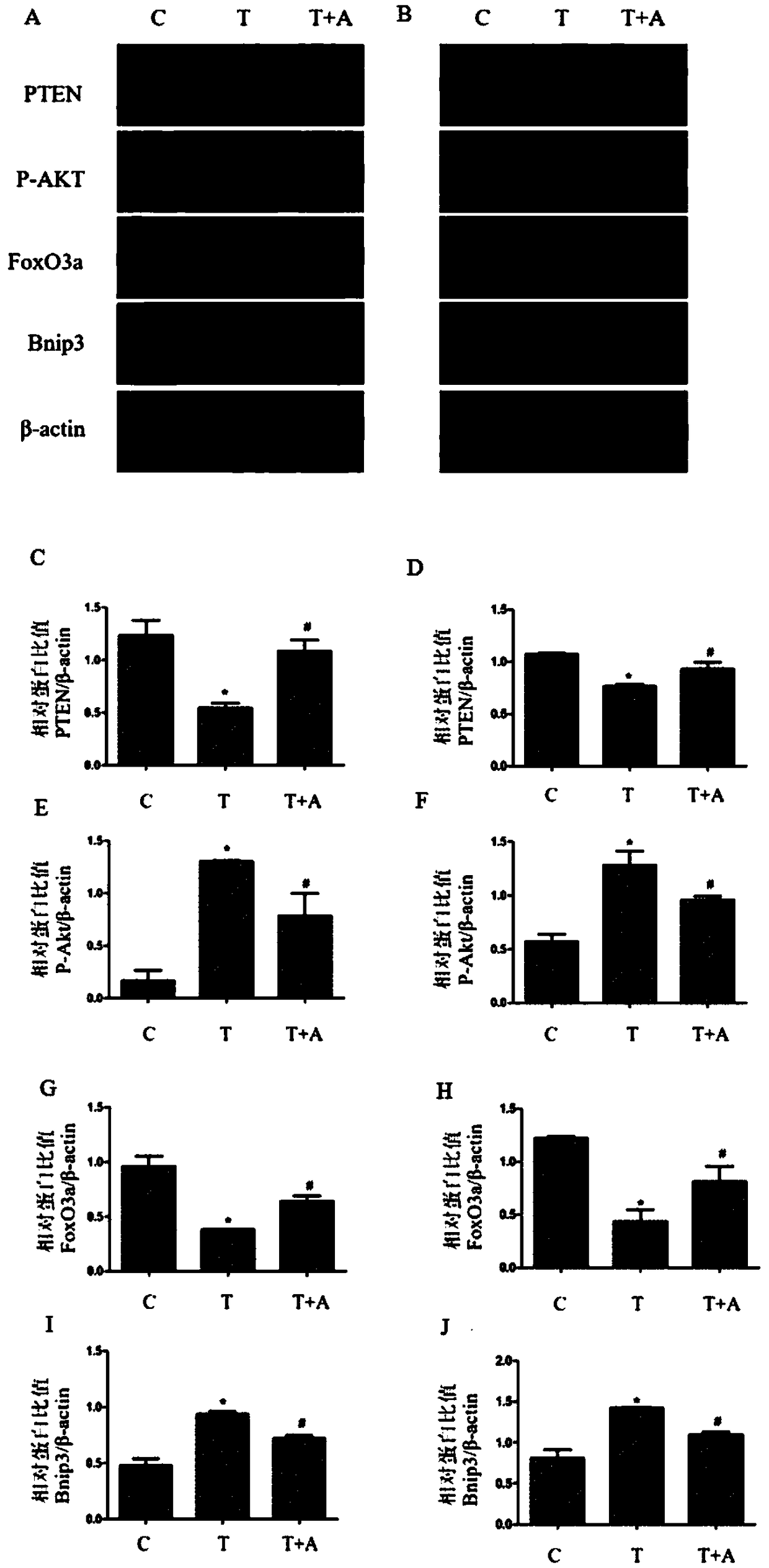 Application of Apelin-13 in preparation of drugs for treating cerebral trauma