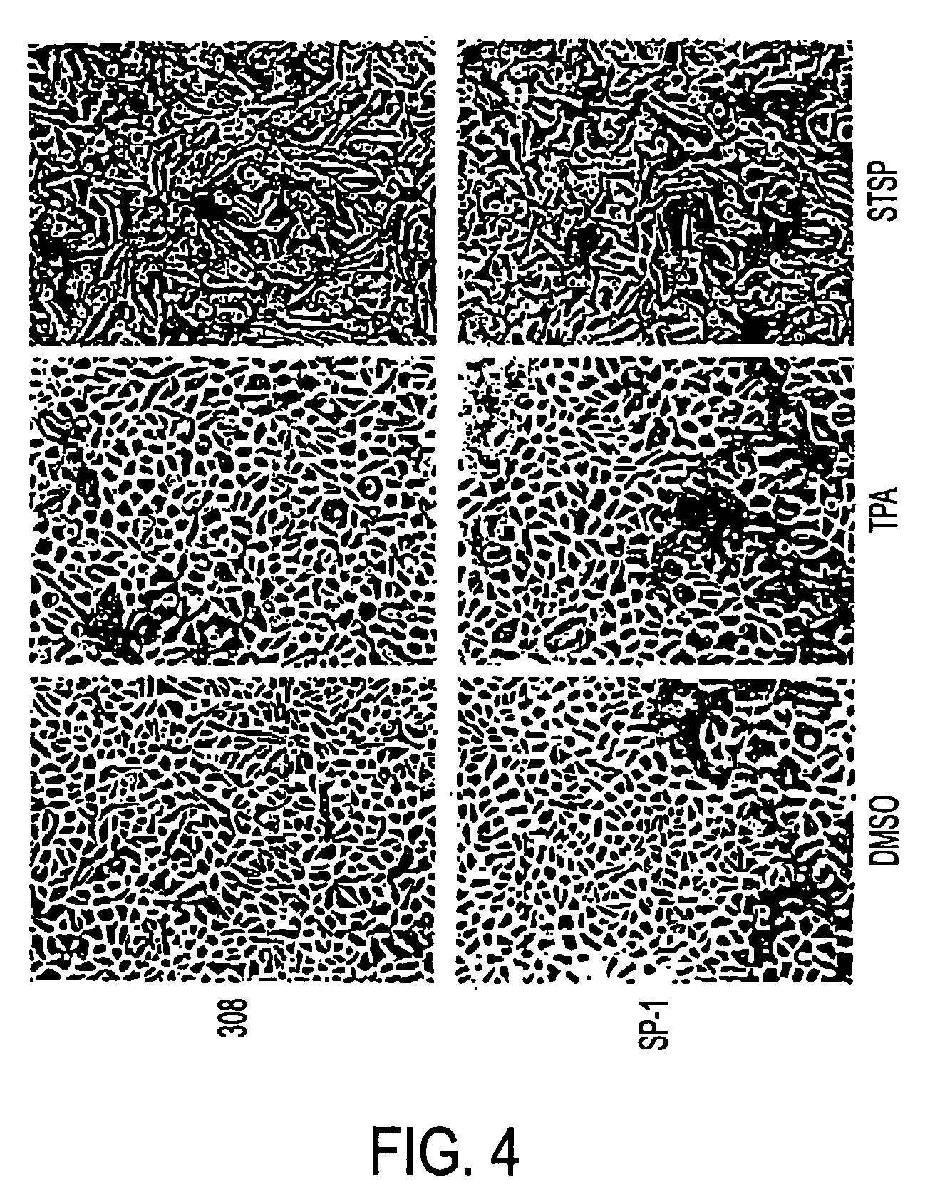 Pharmaceutical compositions and methods for preventing skin tumor formation and causing regression of existing tumors