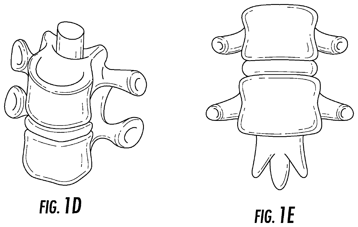 Device and method for correcting spinal deformities in patients