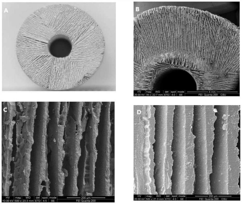 Personalized calcium phosphate biomimetic bone tissue scaffold and its preparation method and application