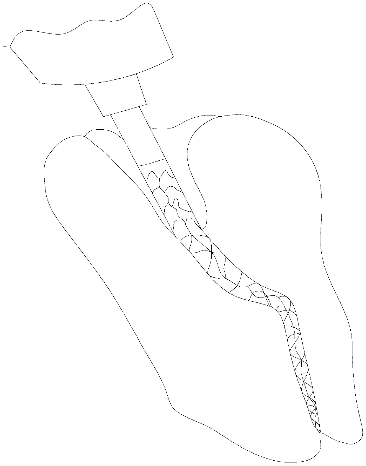 Tooth root file with corner protection device