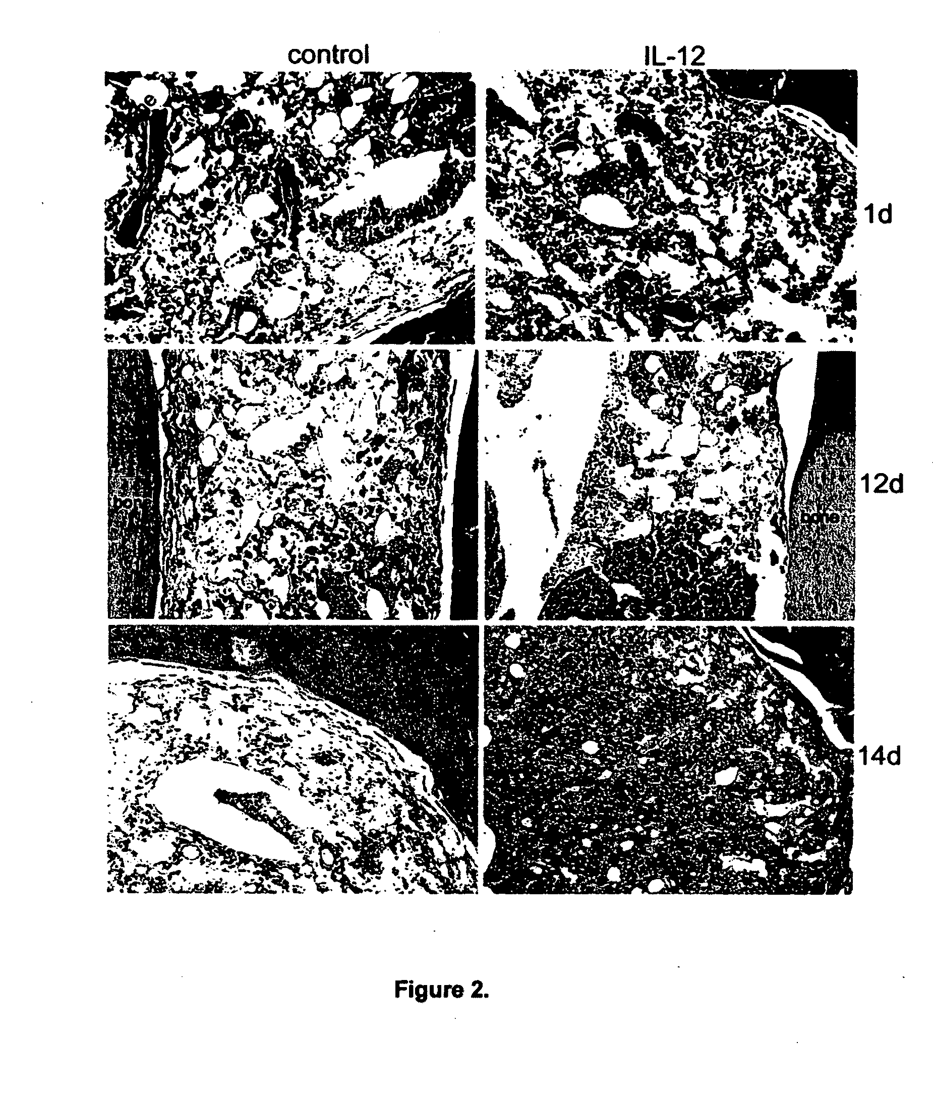 Method for treating deficiency in hematopoiesis