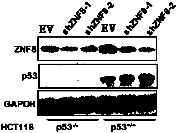 Application of substance for inhibiting expression of ZNF8 protein in preparing products for preventing and treating cancer
