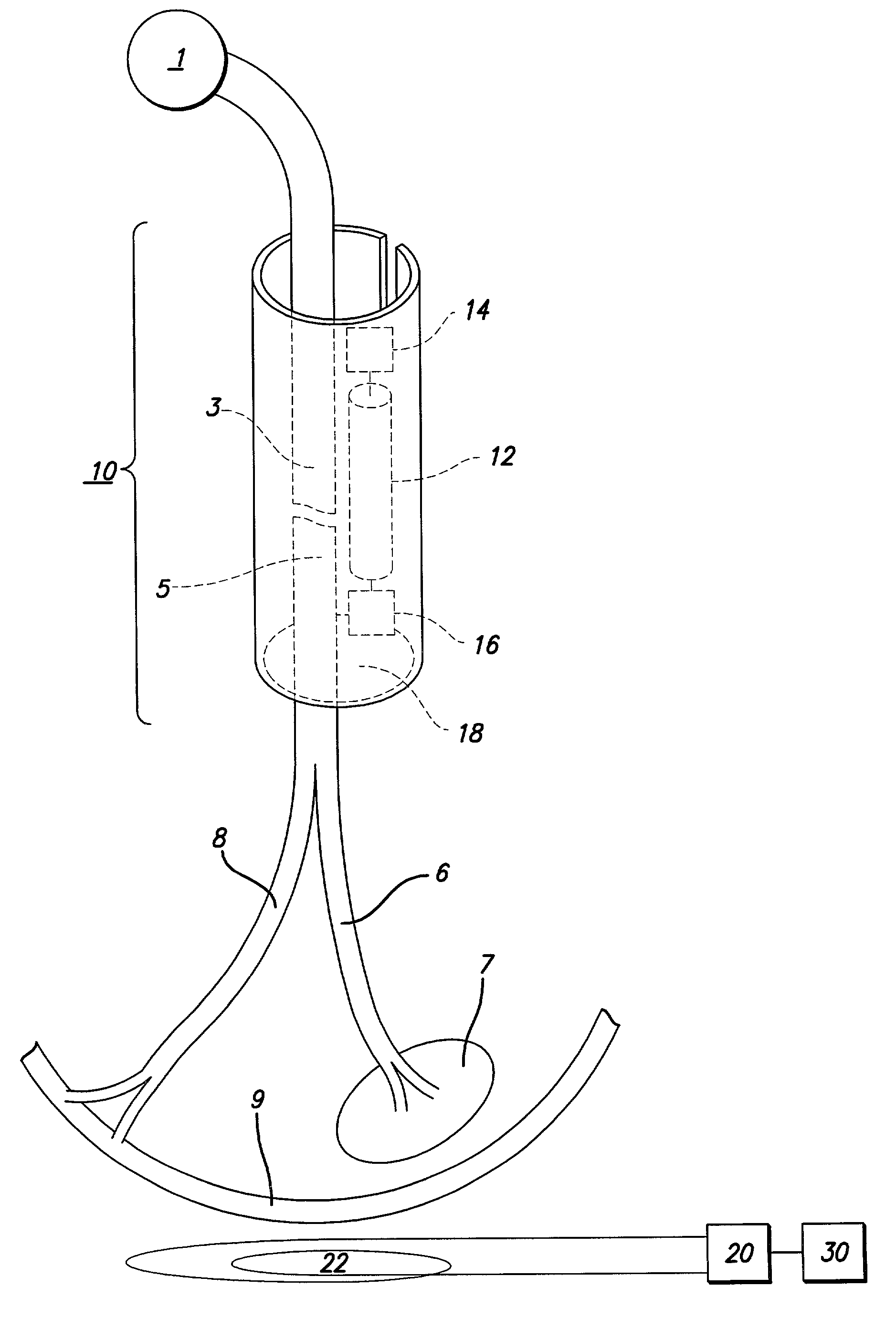 System and method for providing recovery from muscle denervation