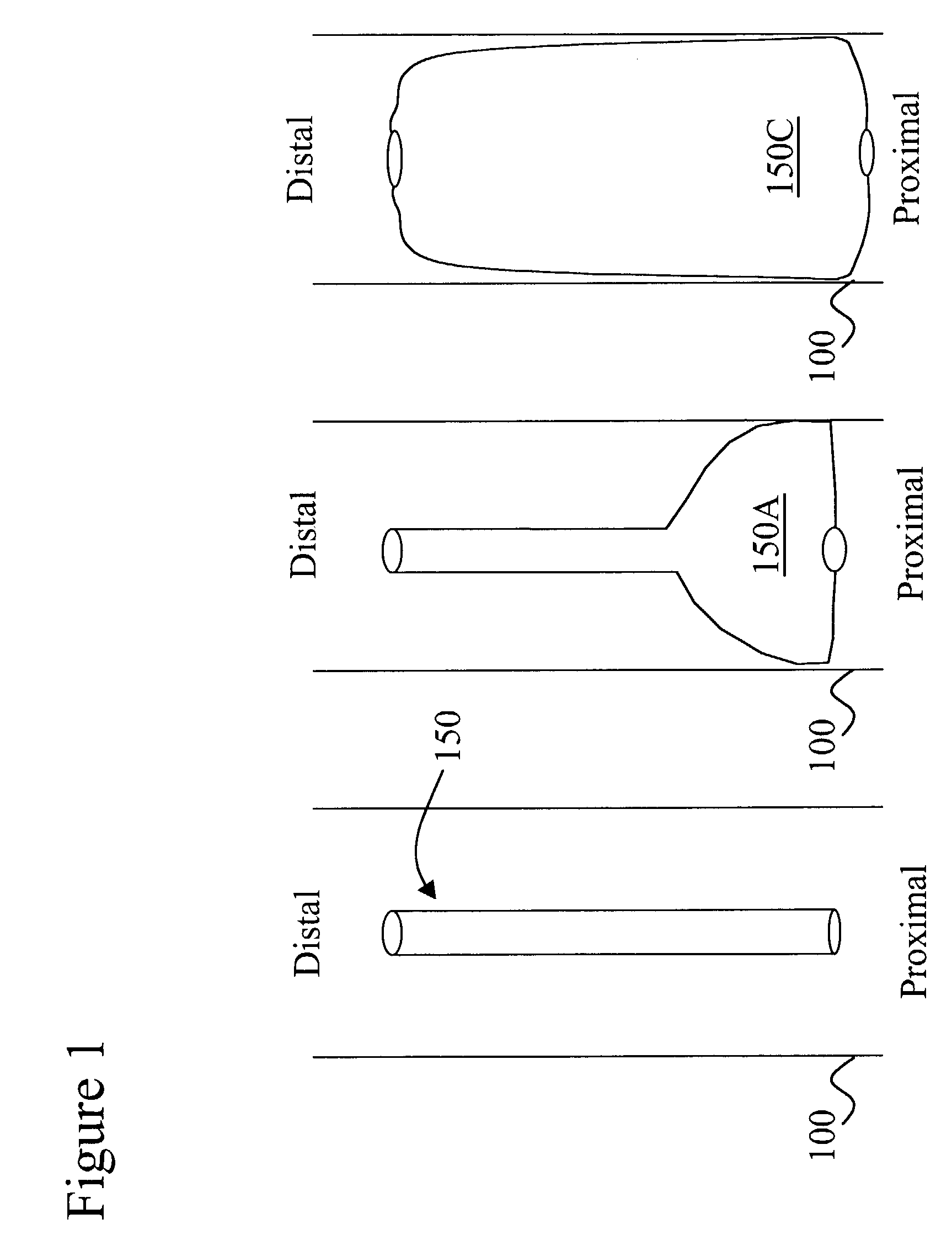 Device and method for medical interventions of body lumens