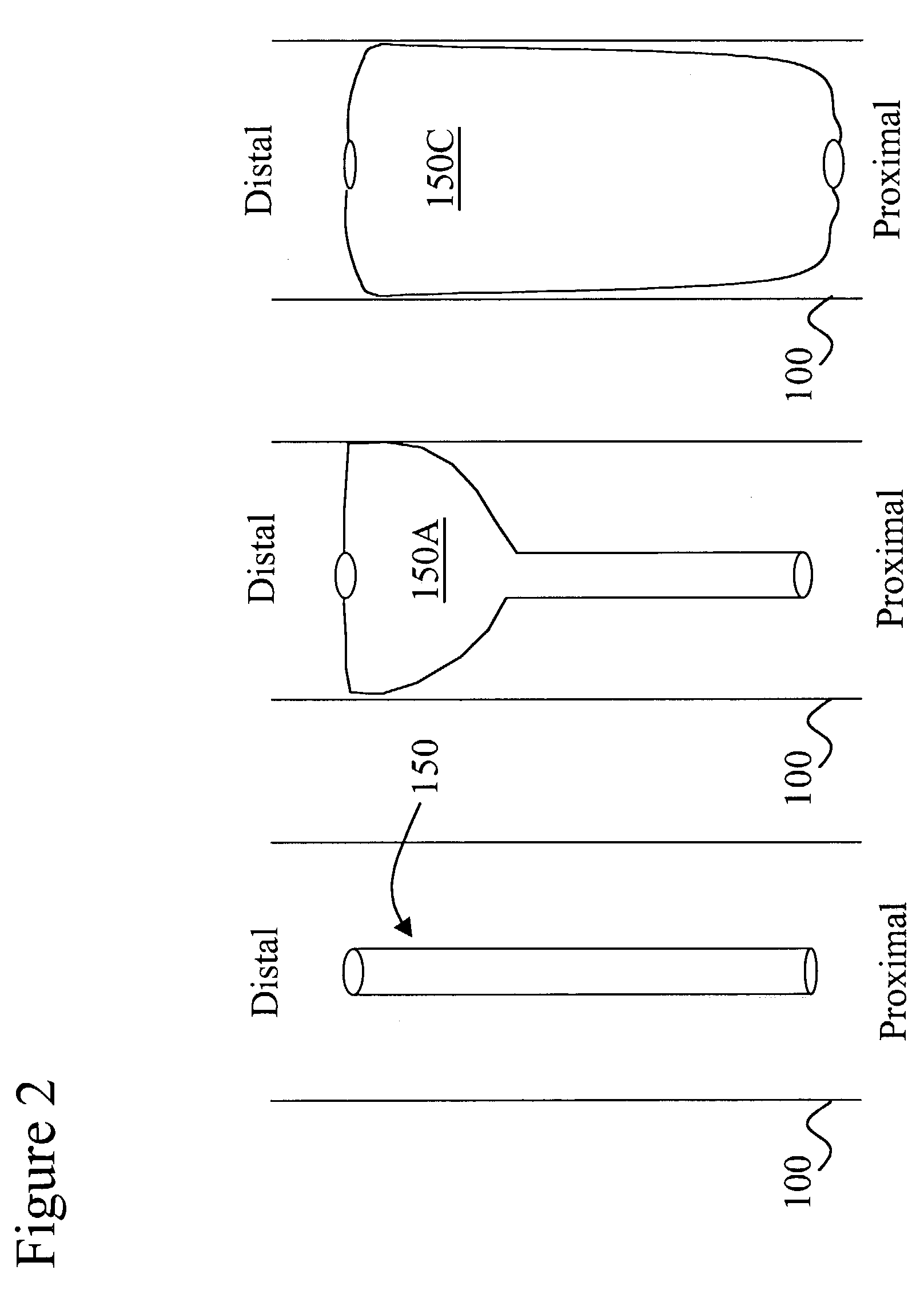 Device and method for medical interventions of body lumens