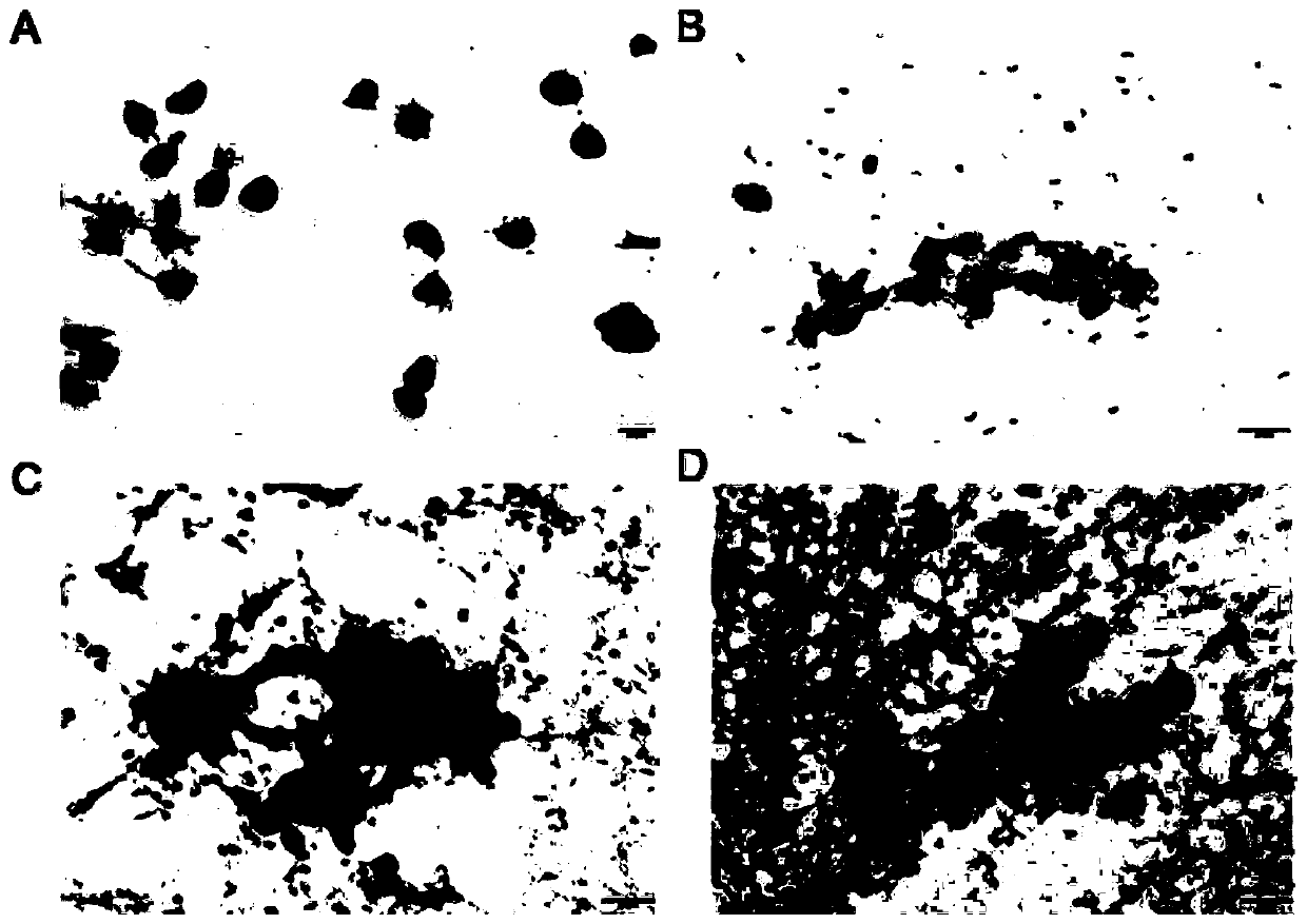 Building method of pancreatic cancer ascites mouse animal model