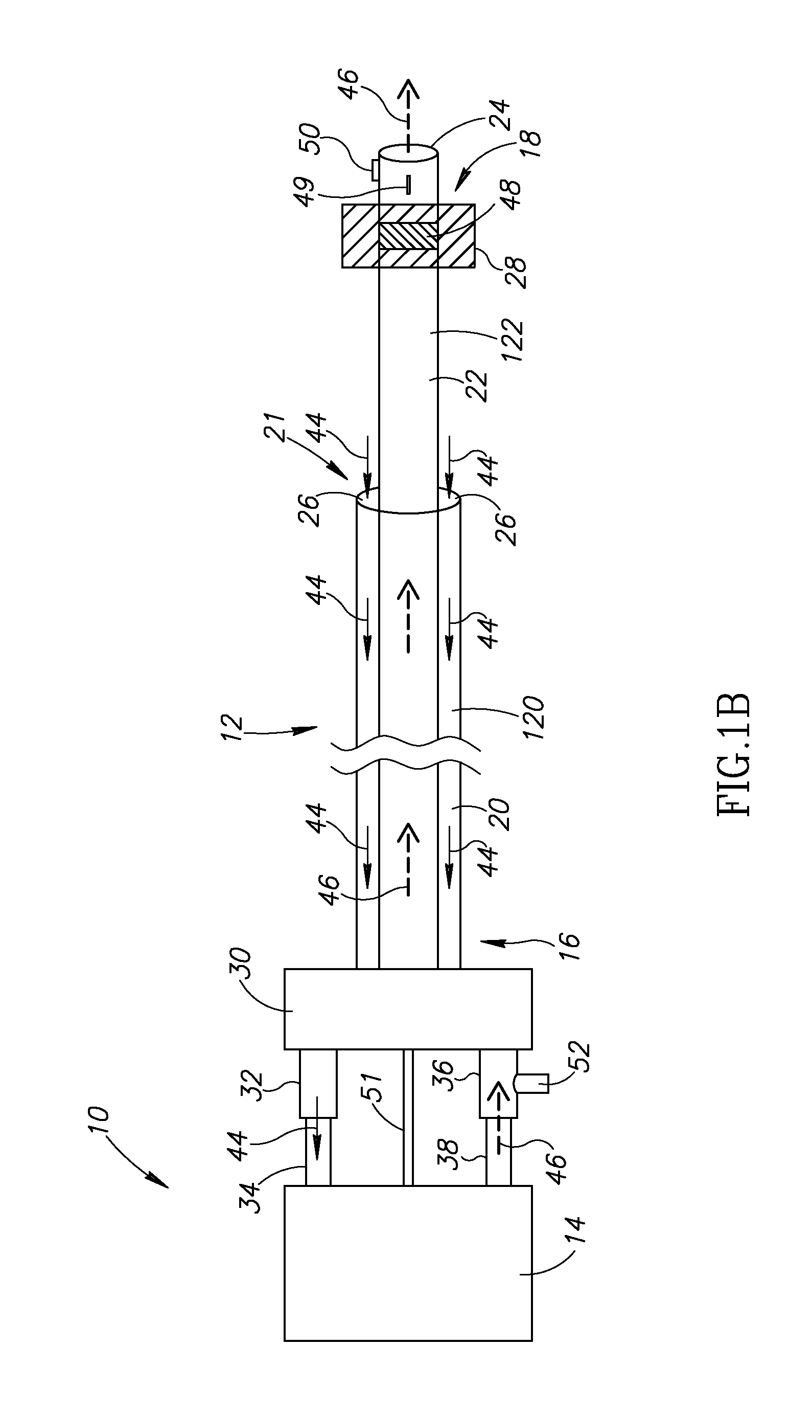 Variable length catheter for drug delivery