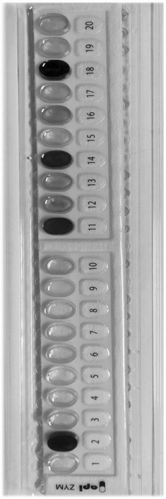 Bacteroides vulgaris strain and its application in preparation of inflammatory bowel disease therapeutic drug