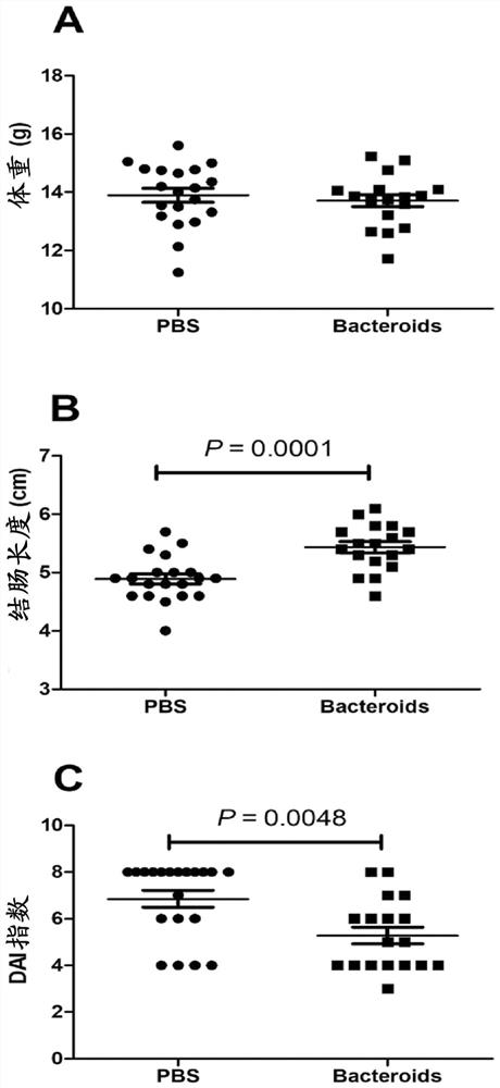 Bacteroides vulgaris strain and its application in preparation of inflammatory bowel disease therapeutic drug