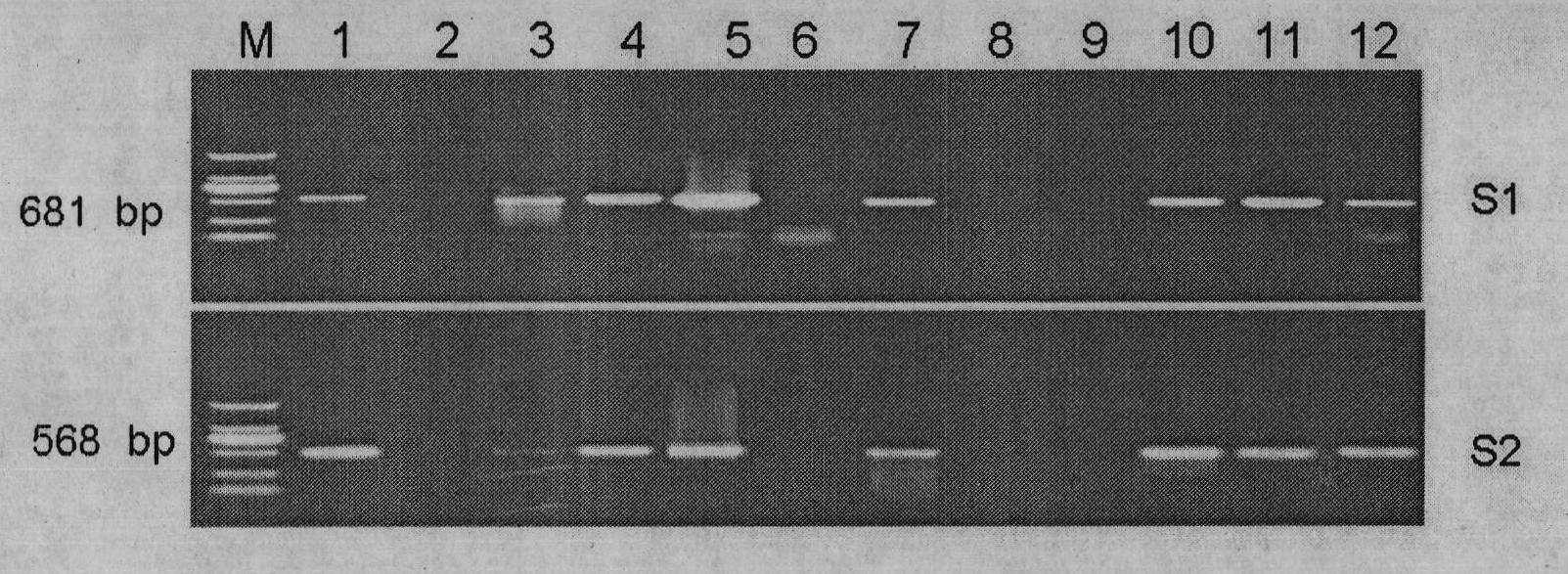 Kit and method for detecting virus infecting situation of Chinese giant salamander colony iridovirus by use of ecdysis