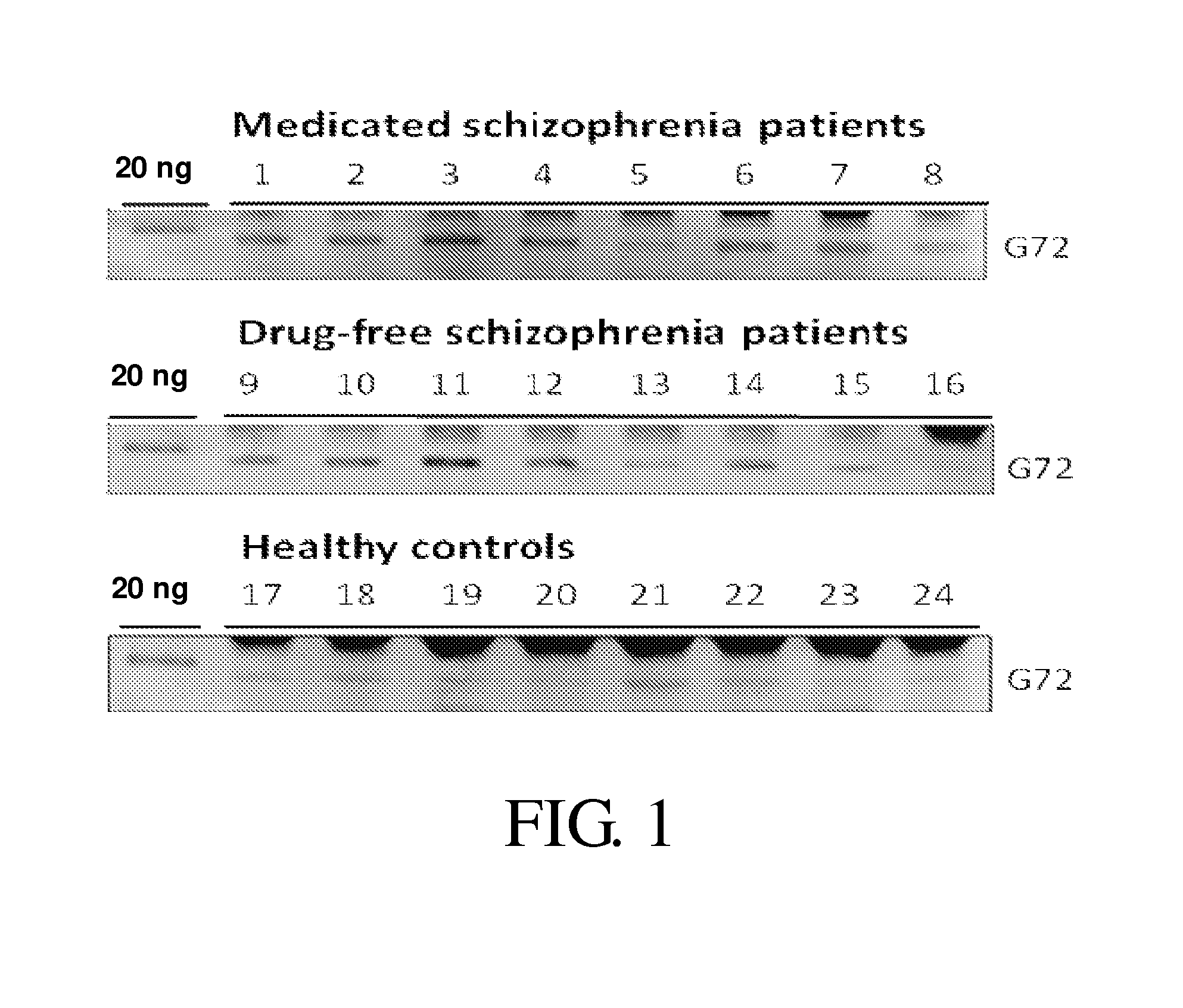 Compositions and methods for diagnosis of schizophrenia