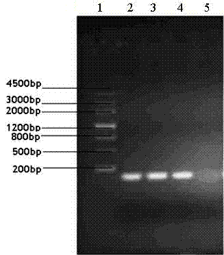 Lactococcus lactis expression vector and preparation method and application thereof