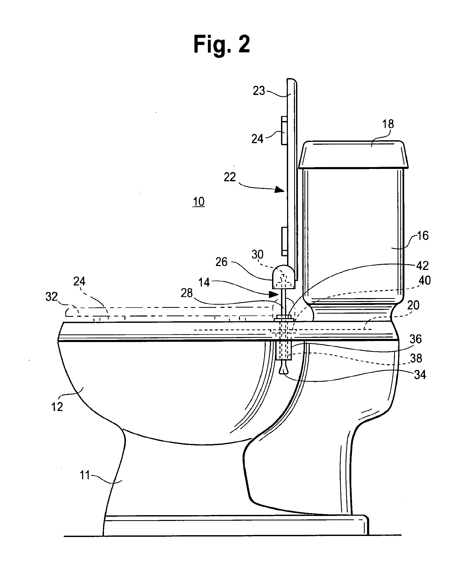 Toilet and toilet seat mounting system