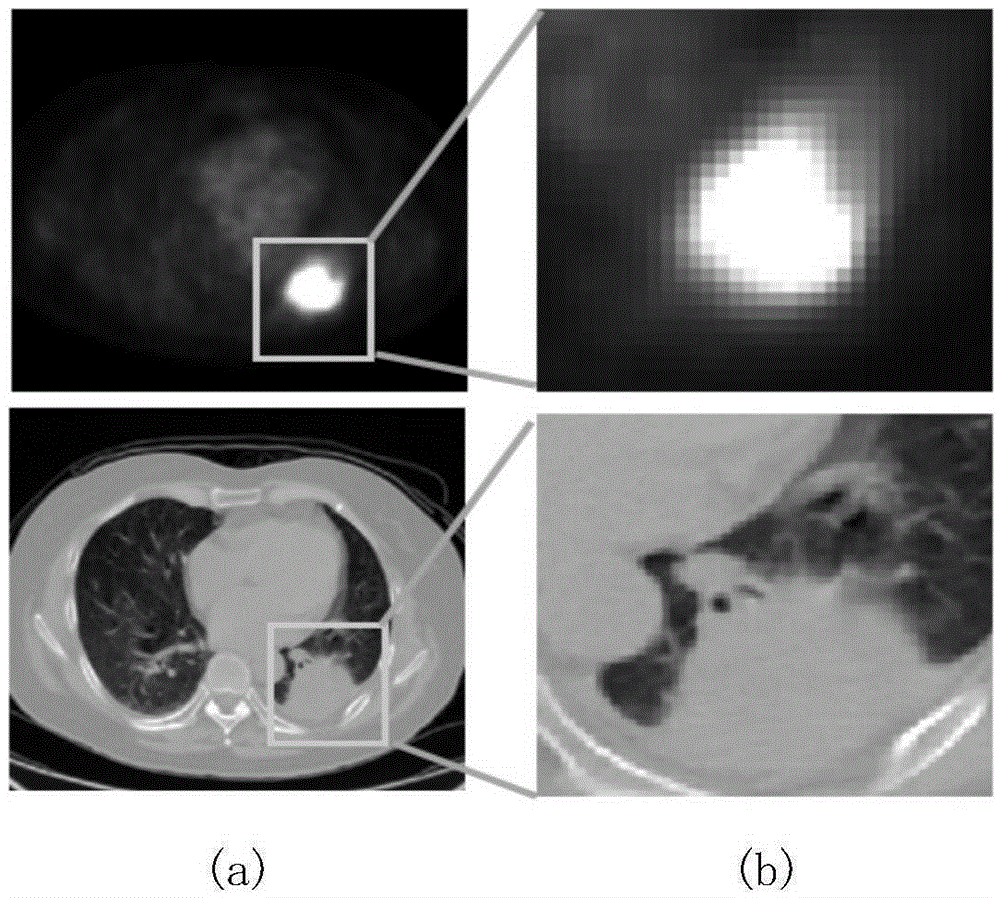 Automatic lung tumour segmentation method based on random forest and monotonically decreasing function