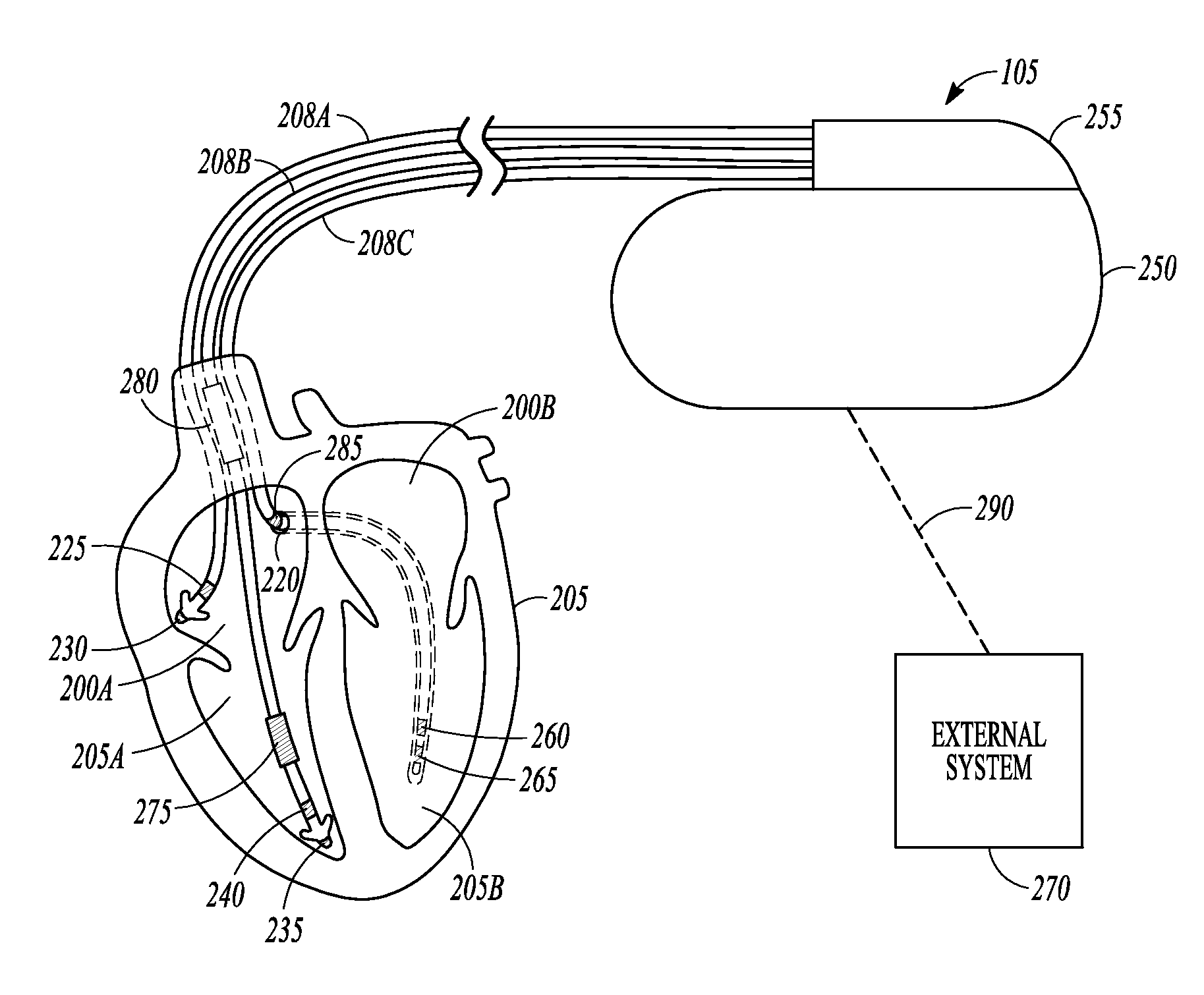 Cardiac contraction detection using information indicative of lead motion